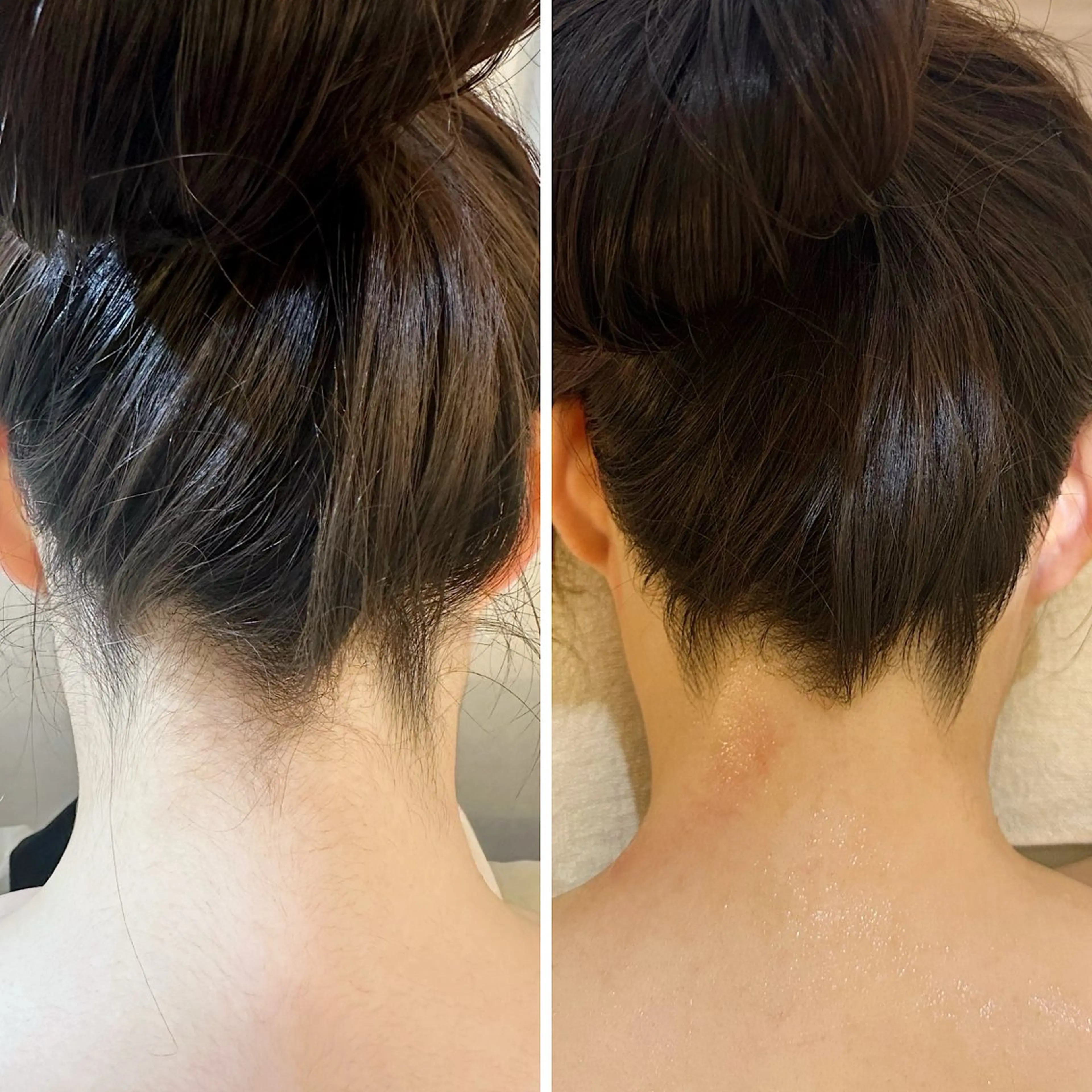 脱毛 うなじ脱毛/美肌脱毛 LABELのエステ・リラクイメージ