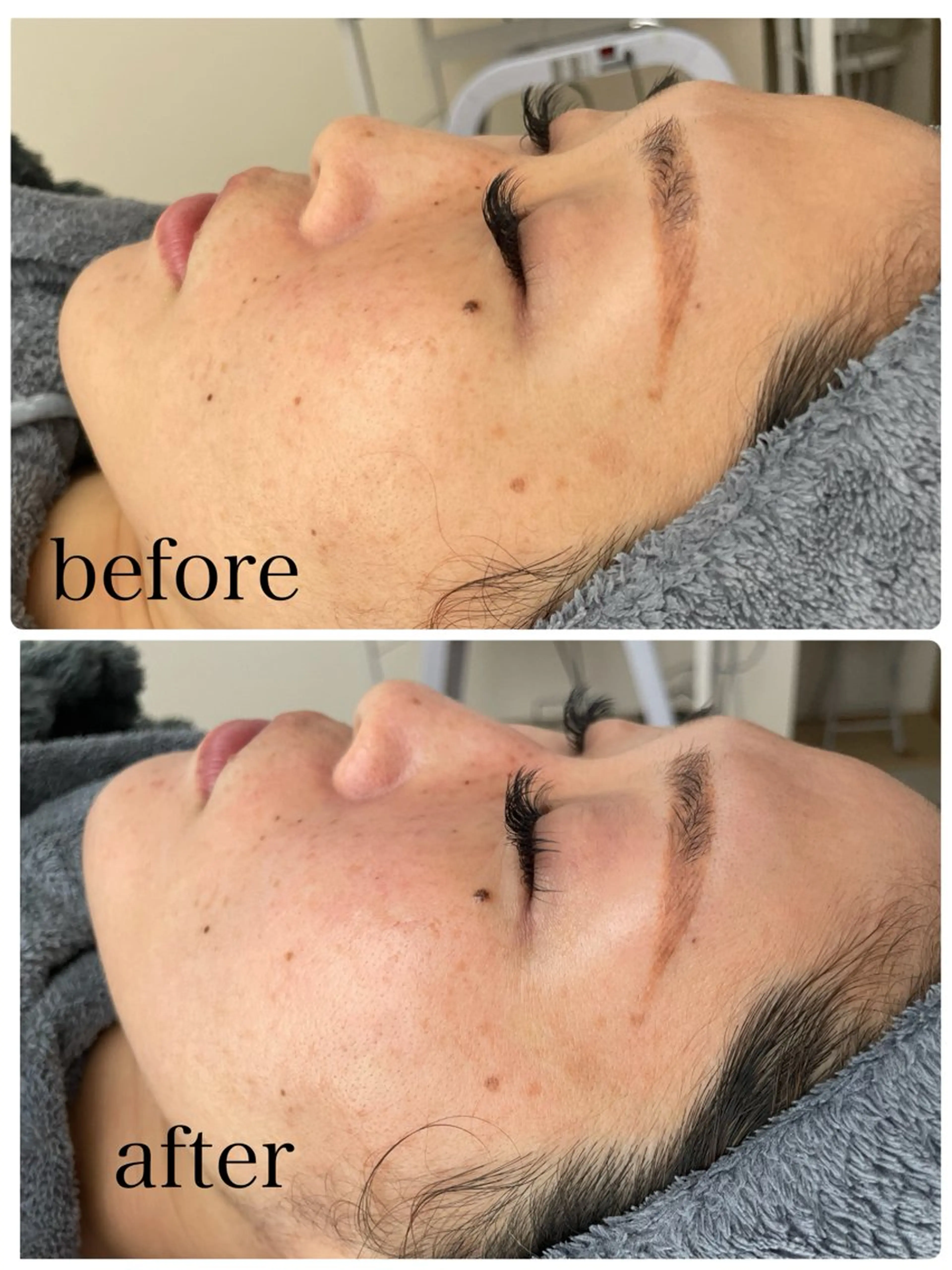 【水光美肌を育てる】ララピールの写真