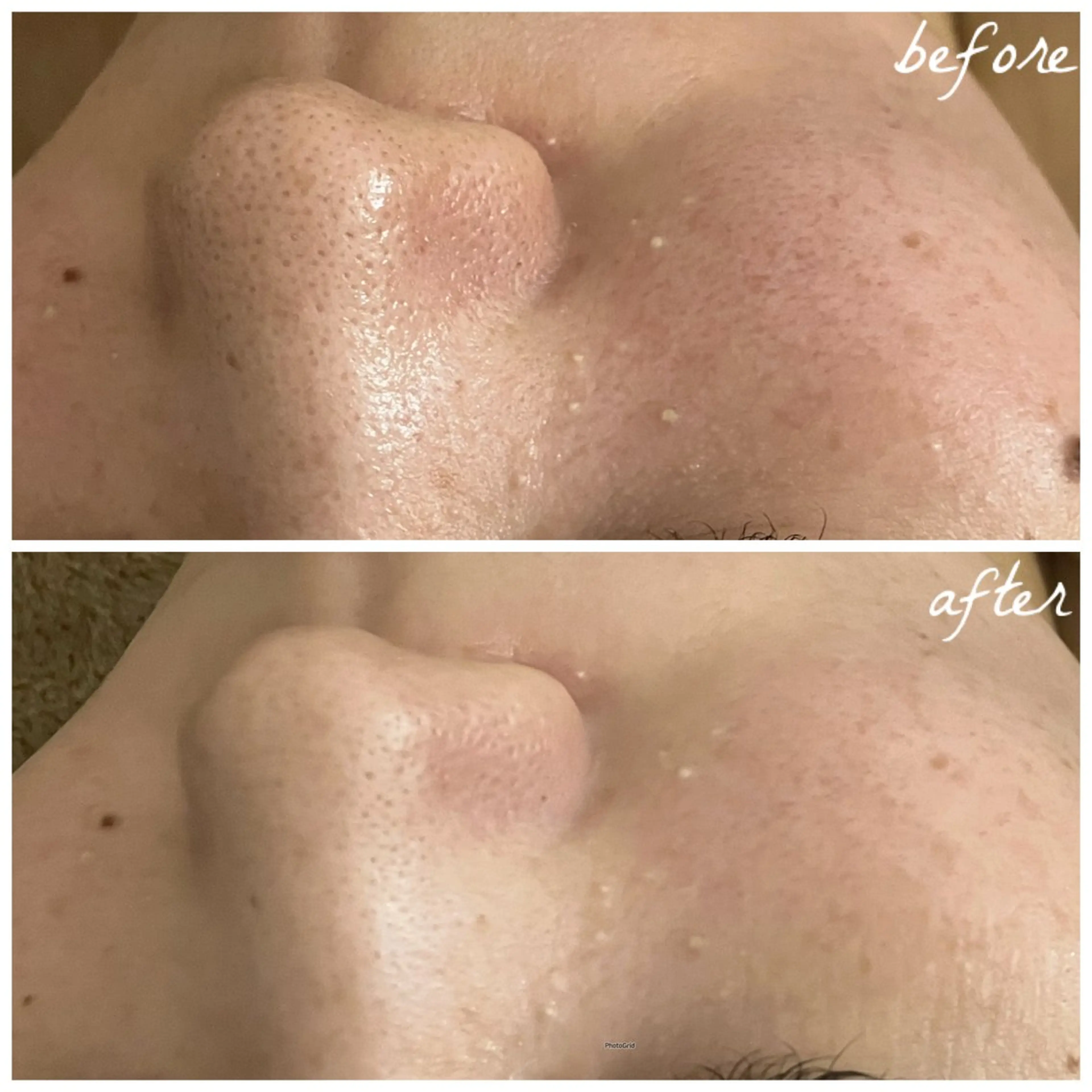 メンズ エステ メナード岐阜茜部 杉浦のエステ・リラクイメージ