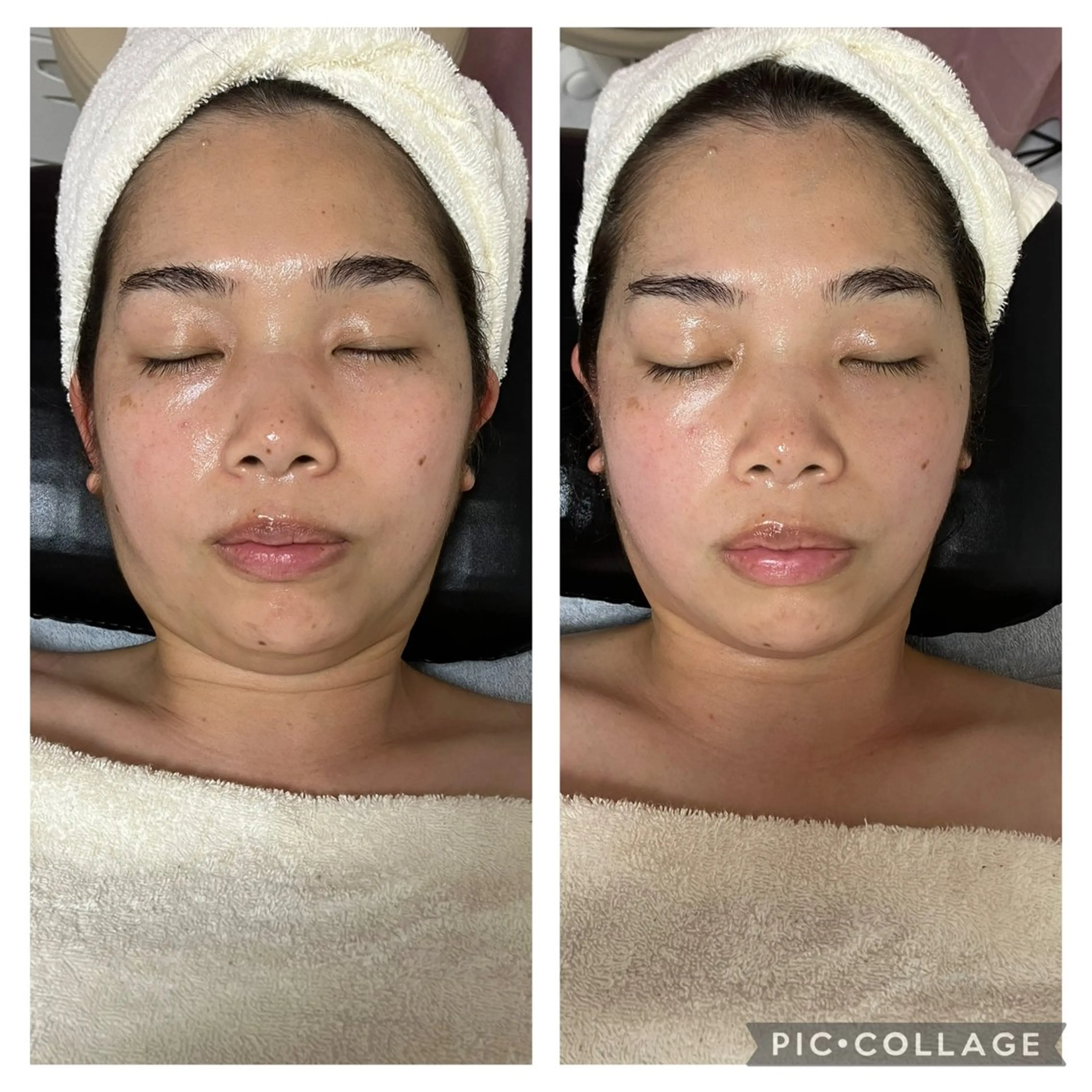 メディカルエステ 痩身·小顔専門サロンBBC 田園調布所属・KEI KOのエステ・リラクイメージ