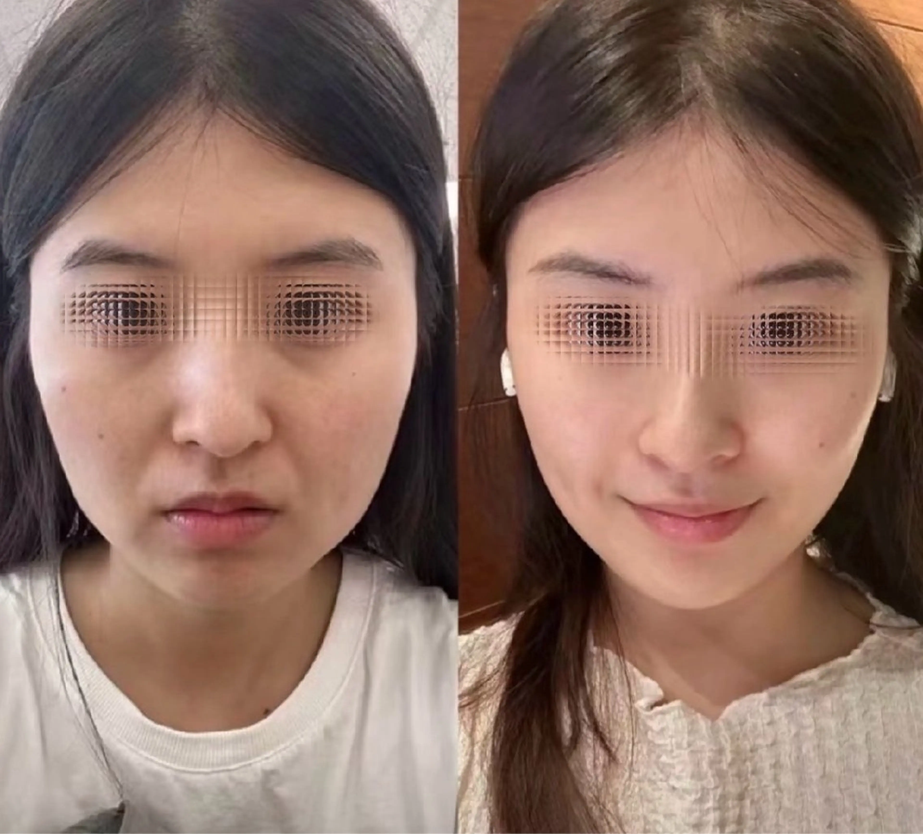 マツエク・マツパ エステ リラク 愛維美水光美肌専門店所属・愛維美水光美肌専門店 メンズレディースokのエステ・リラクイメージ