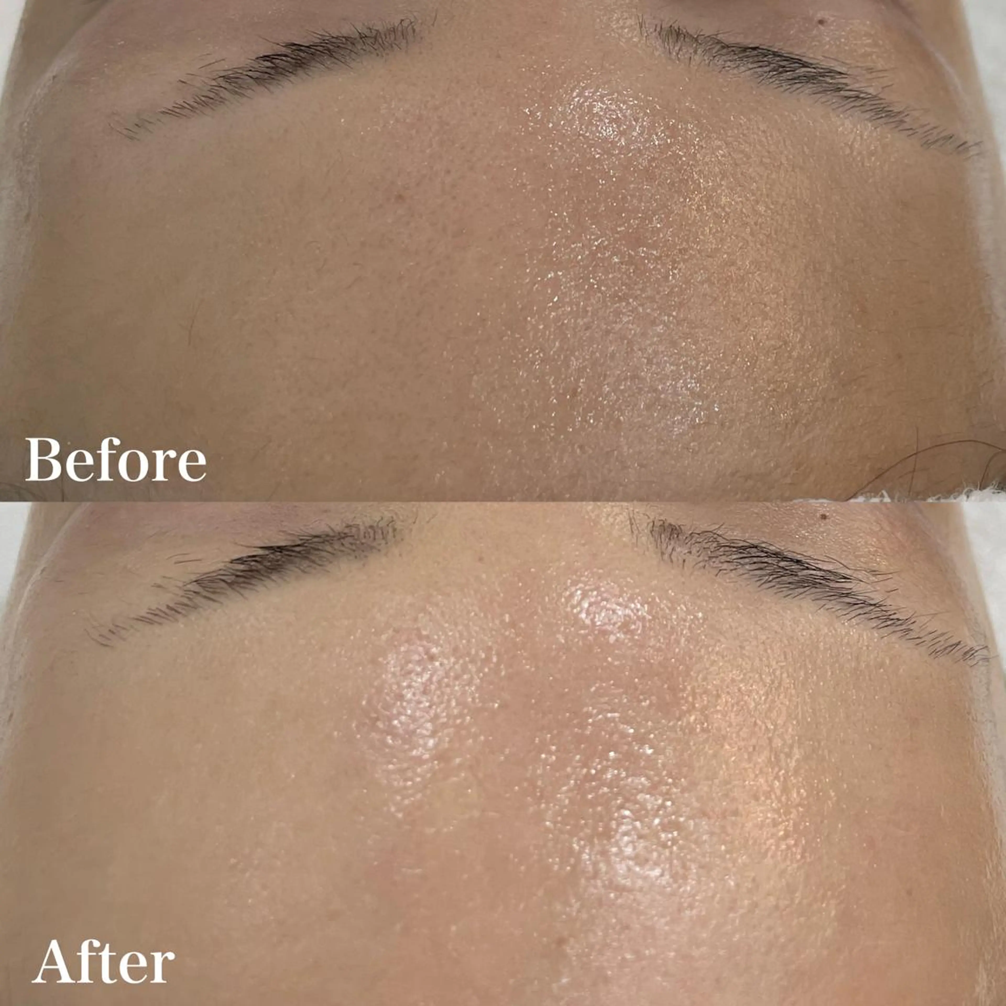 エステ lazo MIYOのマツエク・マツパデザイン