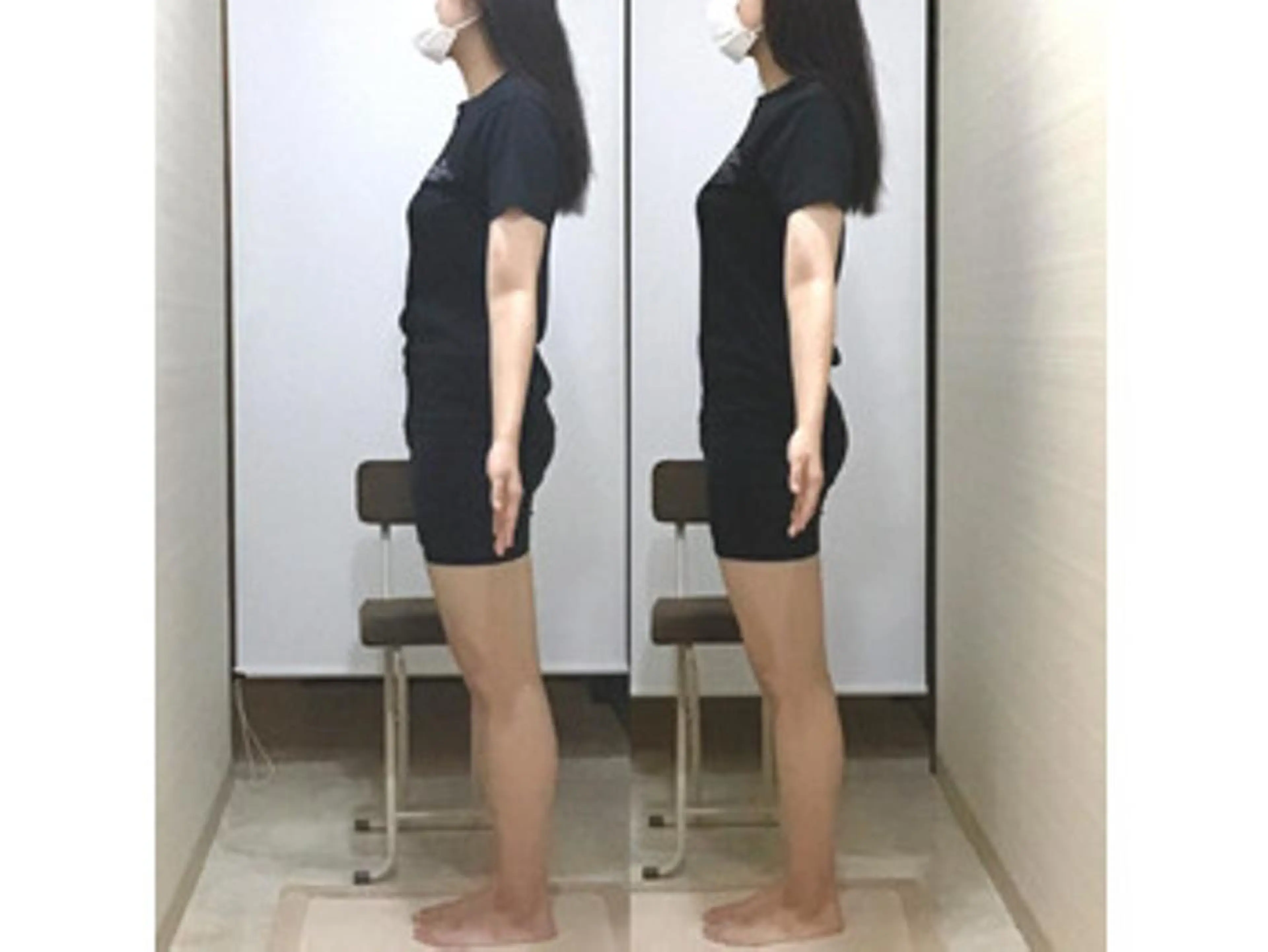 姿勢・骨盤/小顔矯正 痩身ダイエット 横田のエステ・リラクイメージ