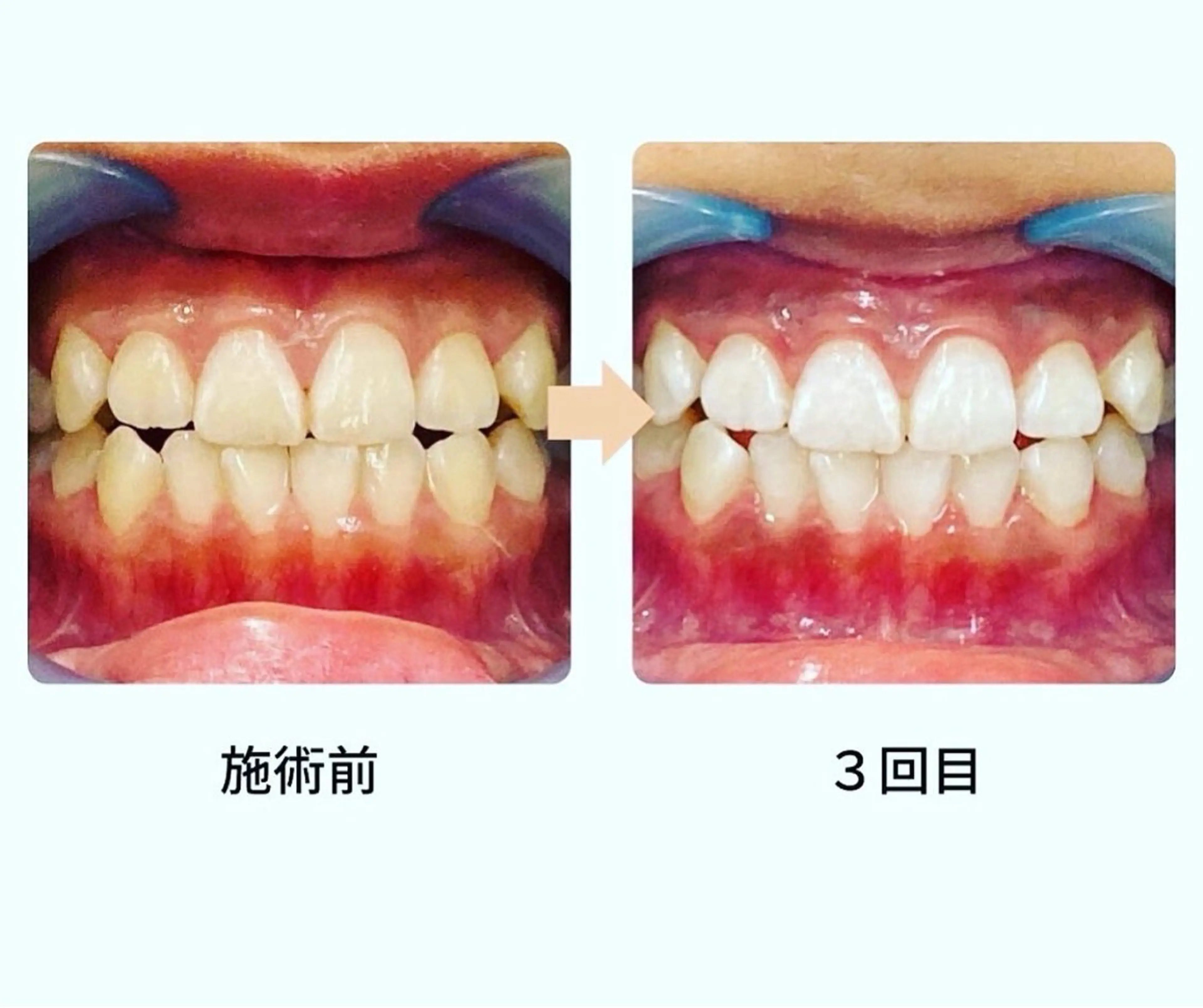 メンズ脱毛サロンReyz（レイズ）所属・熊本メンズ脱毛サロン Reyz（レイズ）のエステ・リラクイメージ