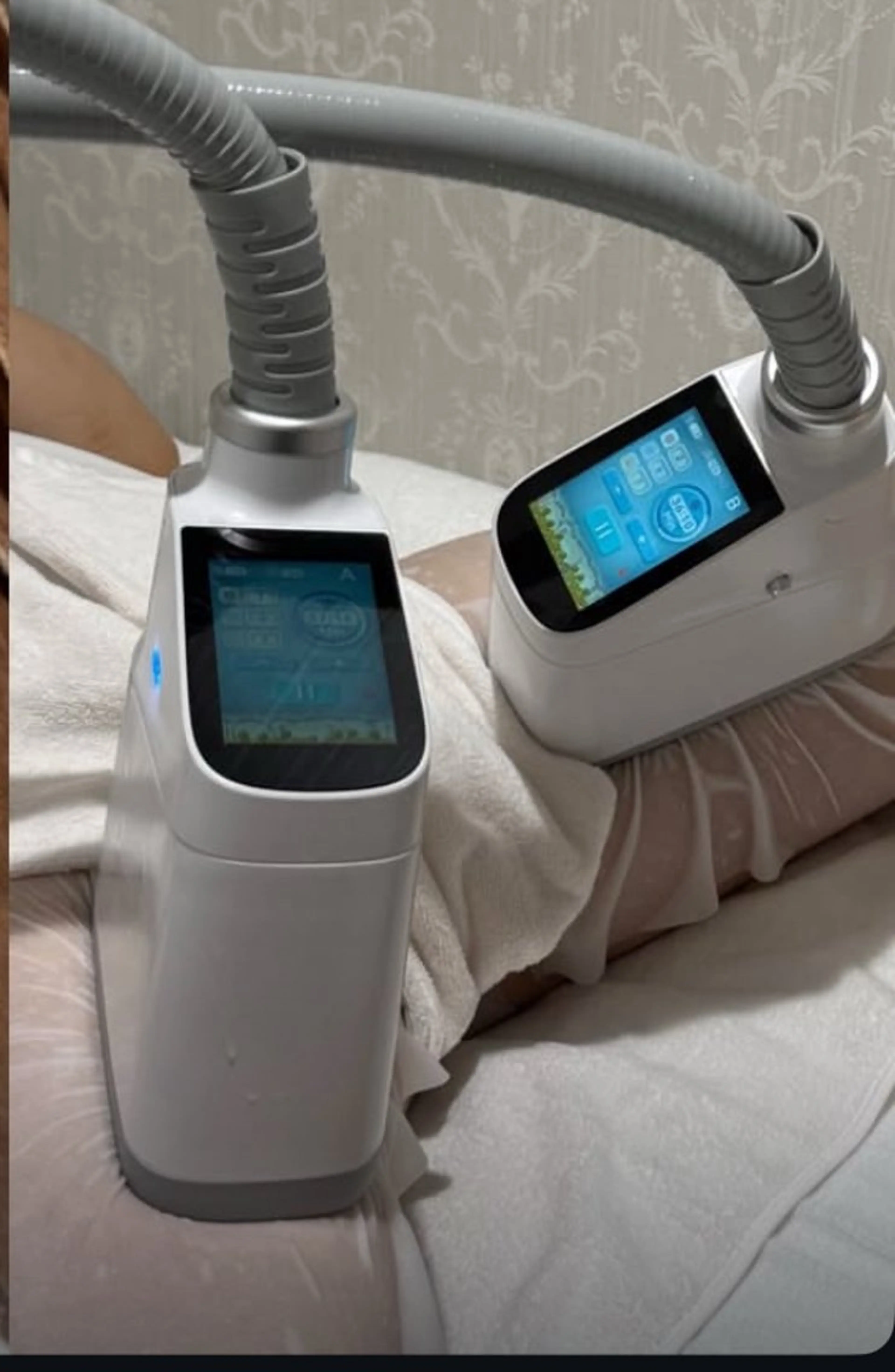 導入キャンペーン！脂肪は冷やして壊す2箇所🧊❄️(お腹or足)の写真