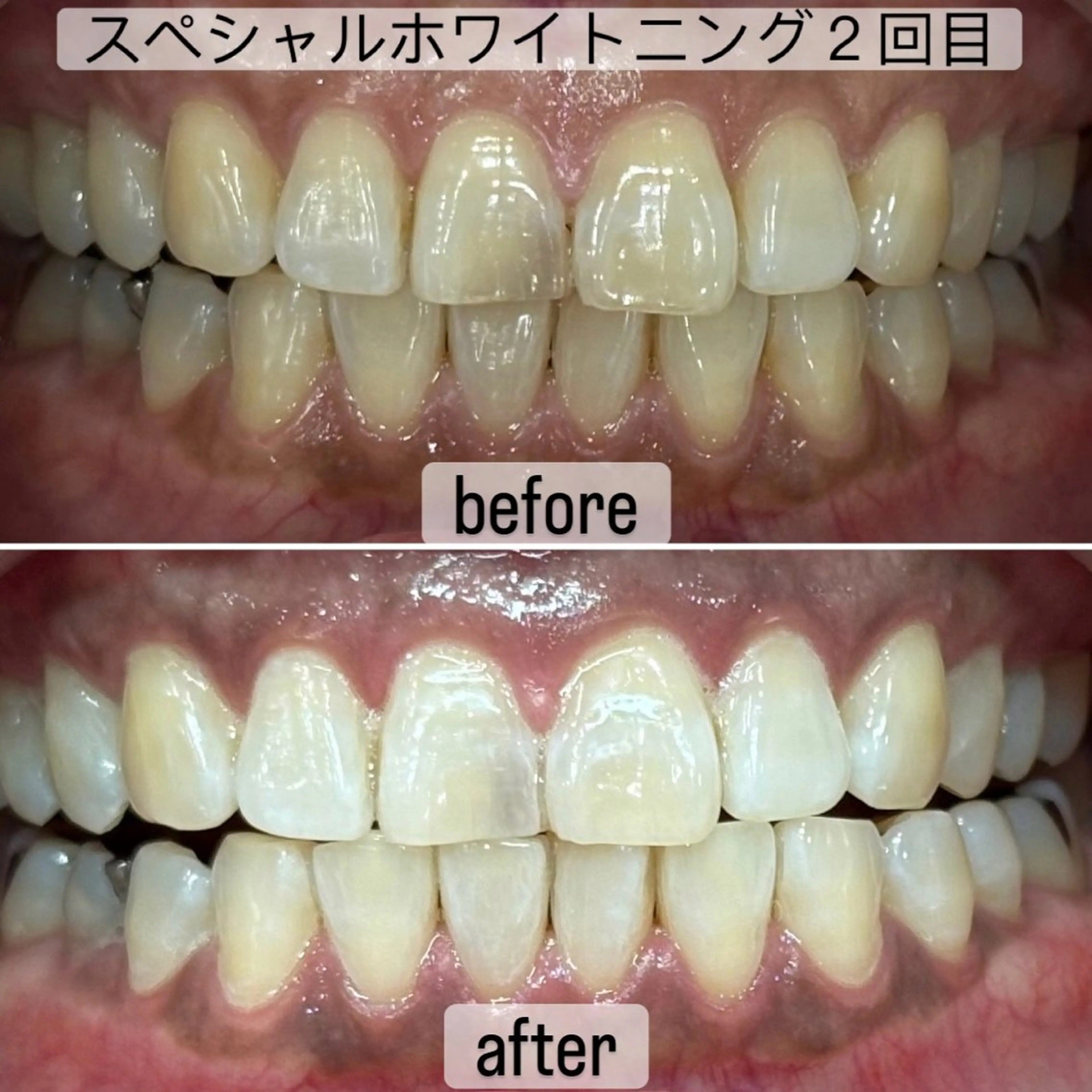 その他 whitening salon yatto.所属・ホワイトニングサロン yatto.のその他イメージ