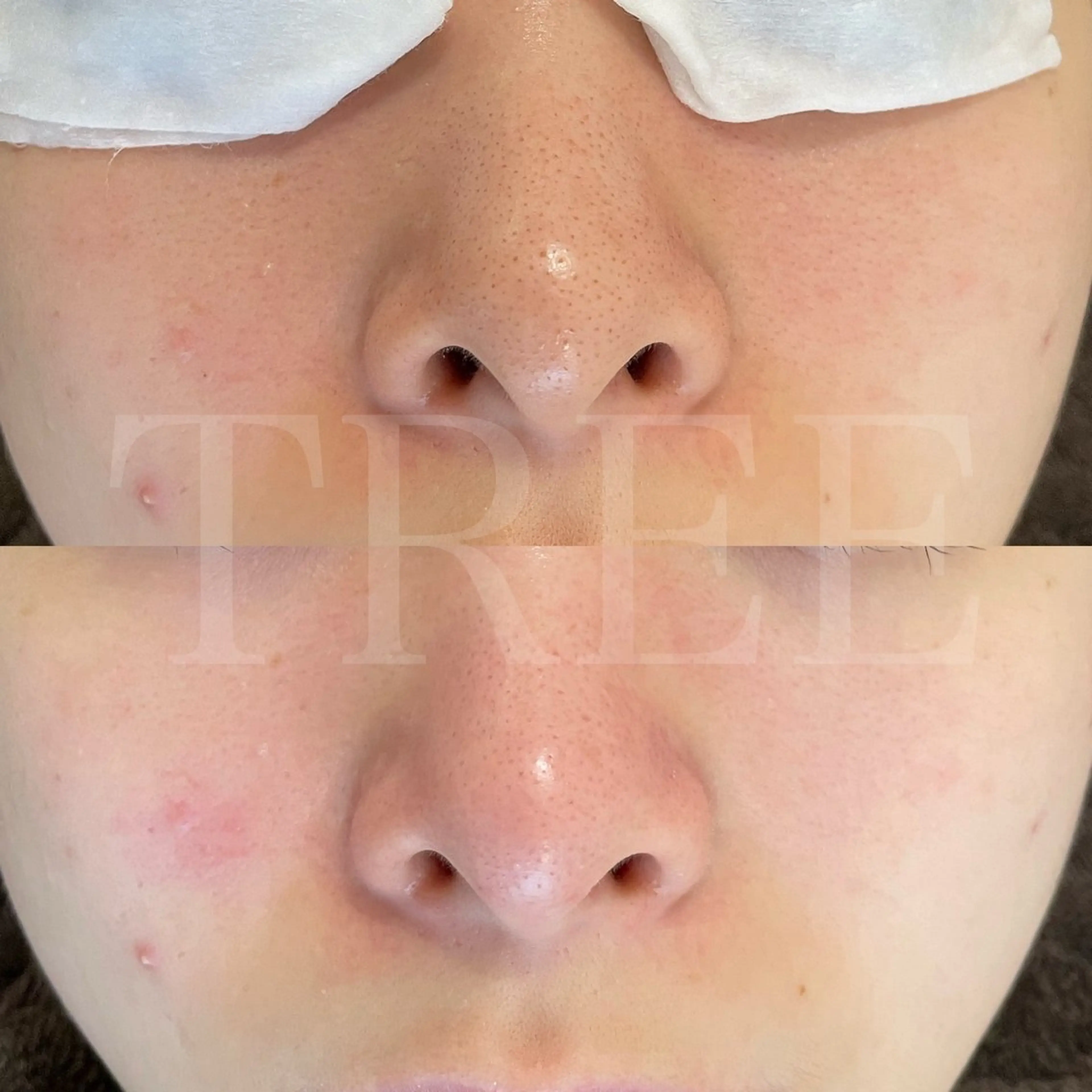 まつげ、毛穴 TREEのエステ・リラクイメージ