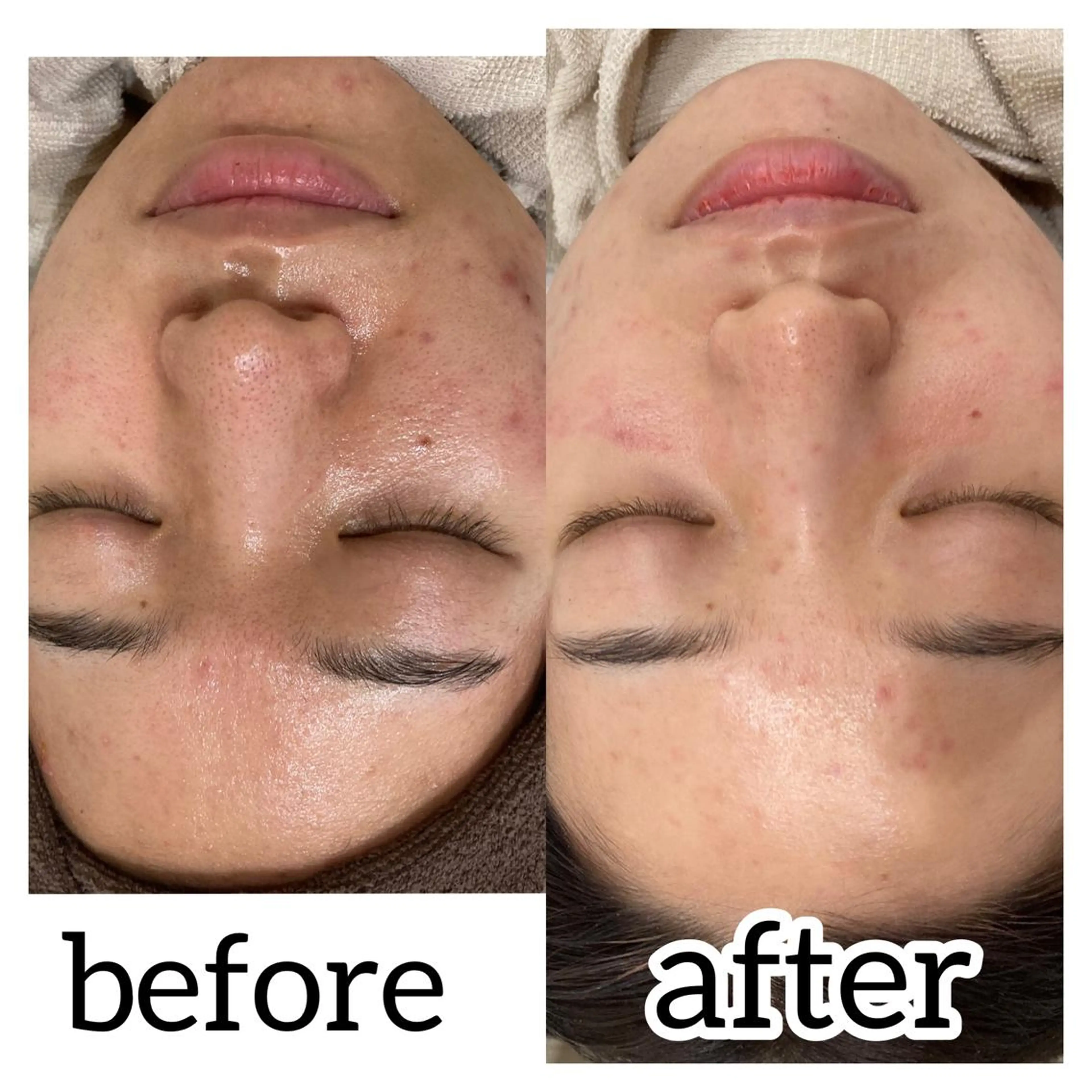 laluna saki...のその他イメージ