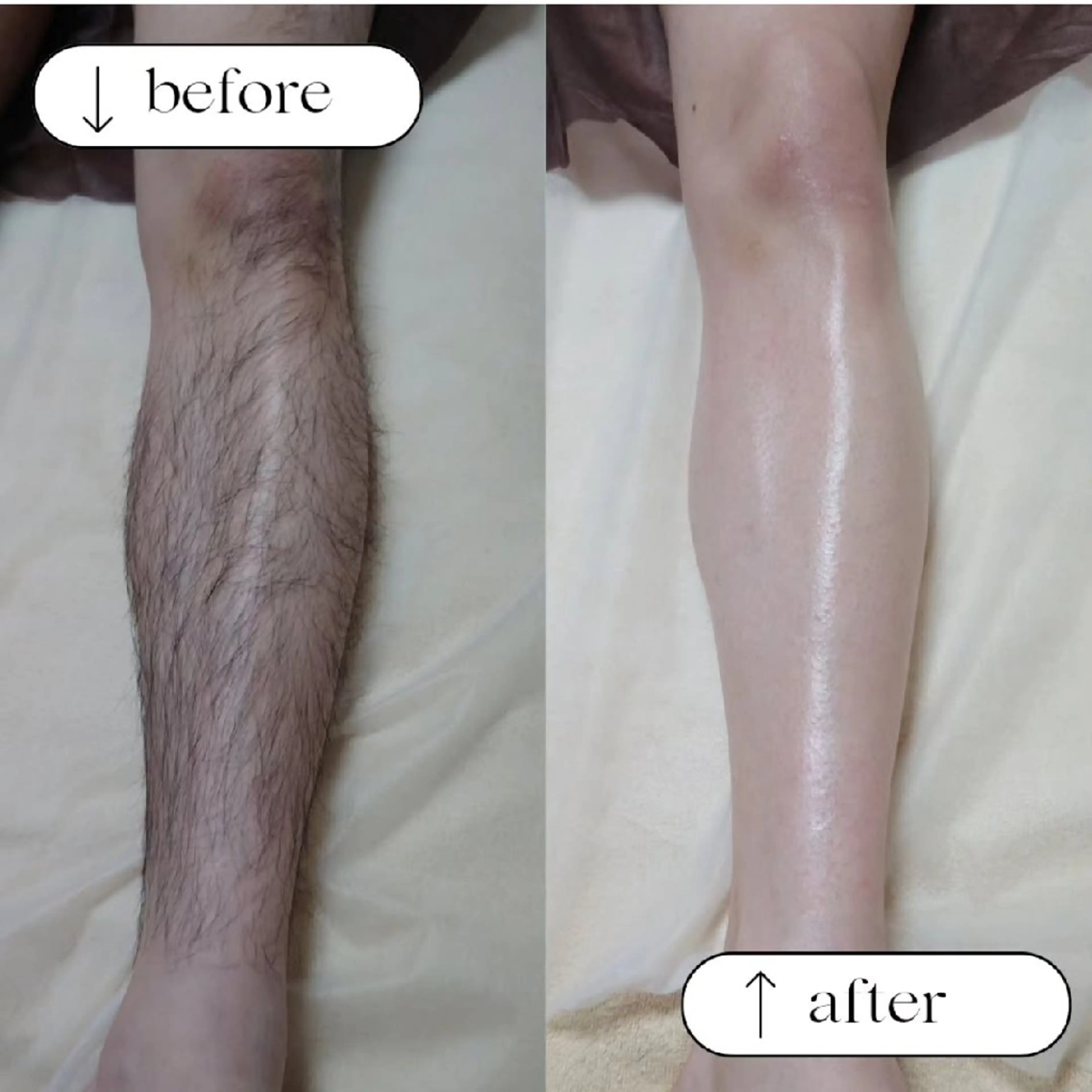 ブラジリアンワックス 脱毛 キナリのエステ・リラクイメージ