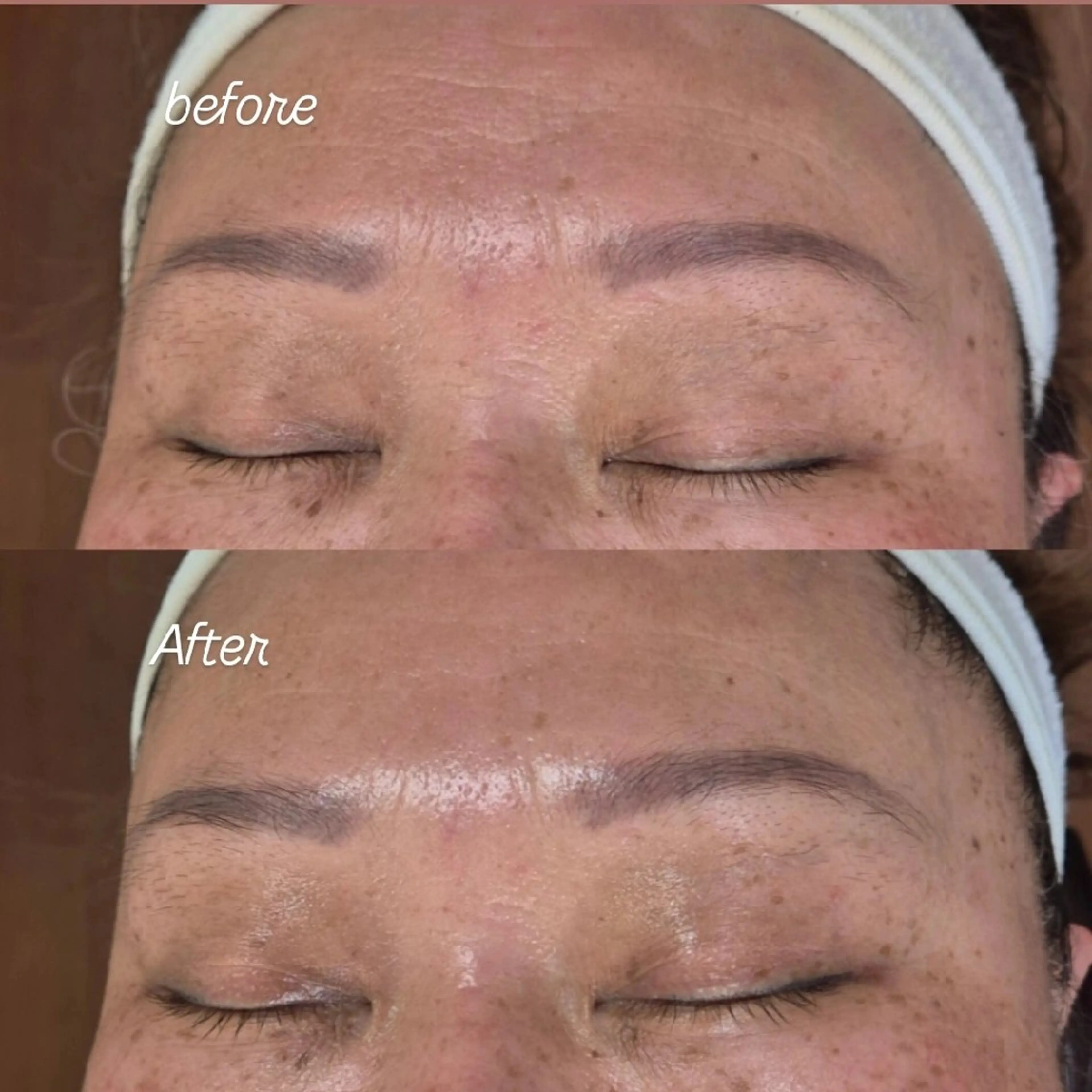 エステ FERNABELL所属・岩本 ひなののエステ・リラクイメージ