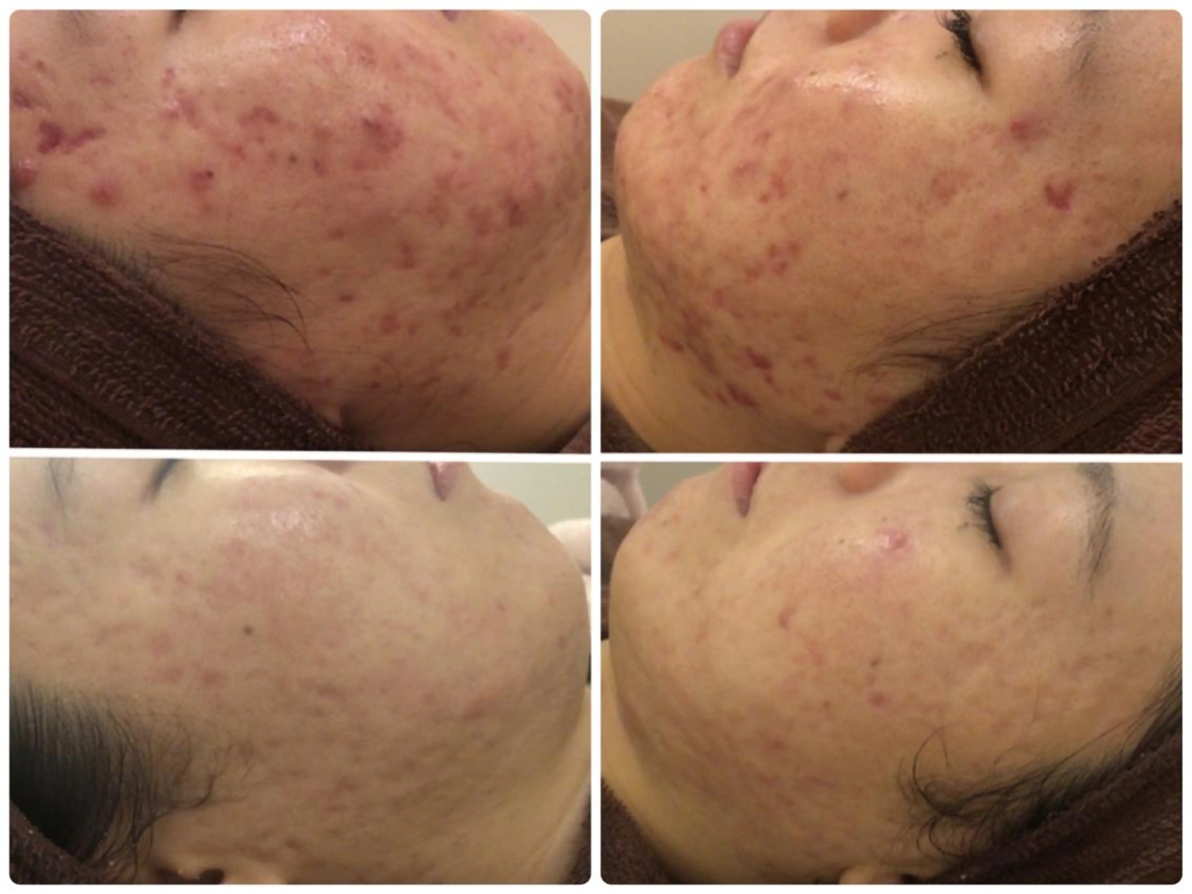 ミディアム カラー パーマ ヘアアレンジ メンズ キッズ ネイル マツエク・マツパ エステ リラク ニキビ・肌質改善専門 ♡人生が変わるサロンのエステ・リラクイメージ