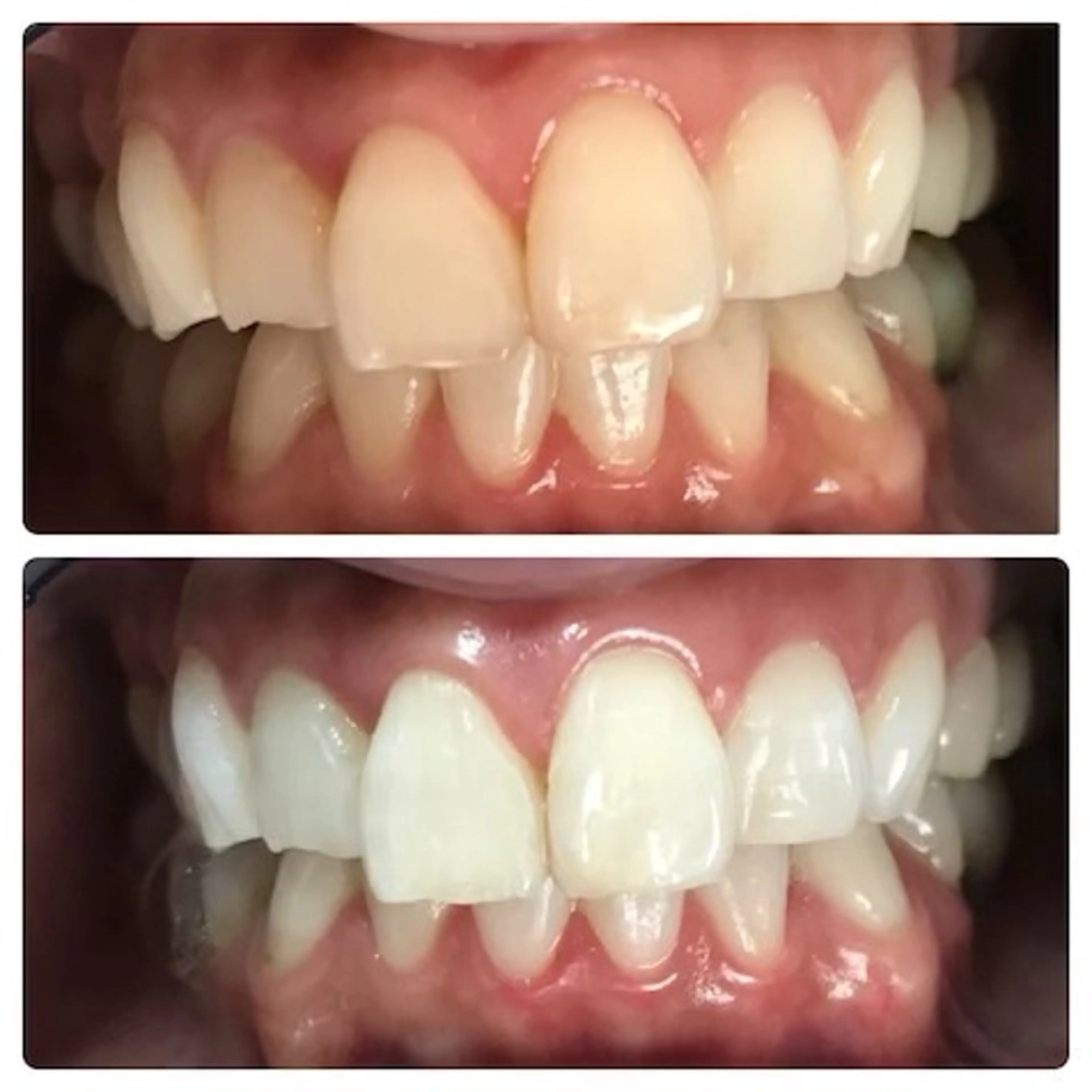 セルフホワイトニング サクッとホワイト 立川店所属・サクッとホワイト 立川店のその他イメージ