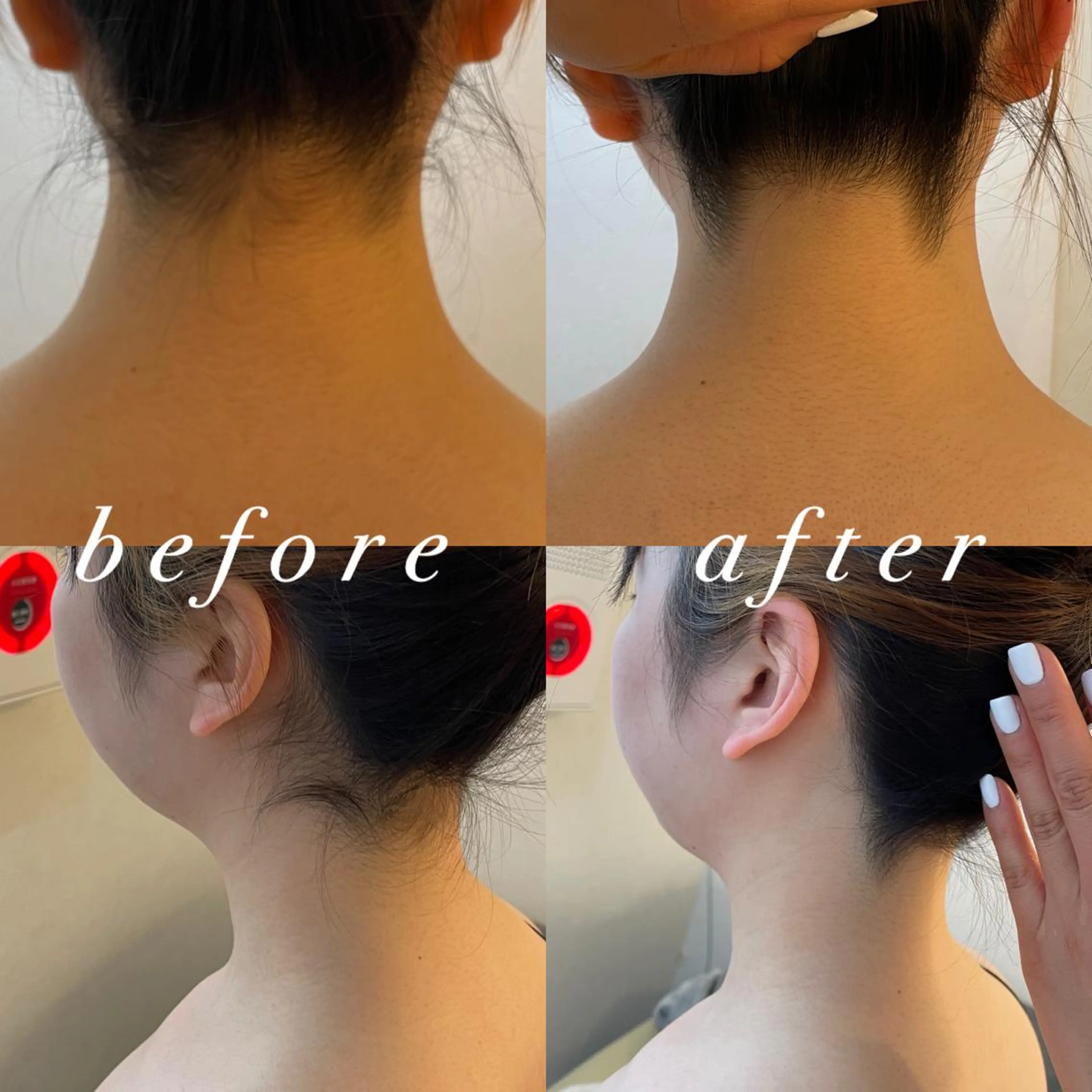 うなじ脱毛/美肌脱毛 LABELのエステ・リラクイメージ