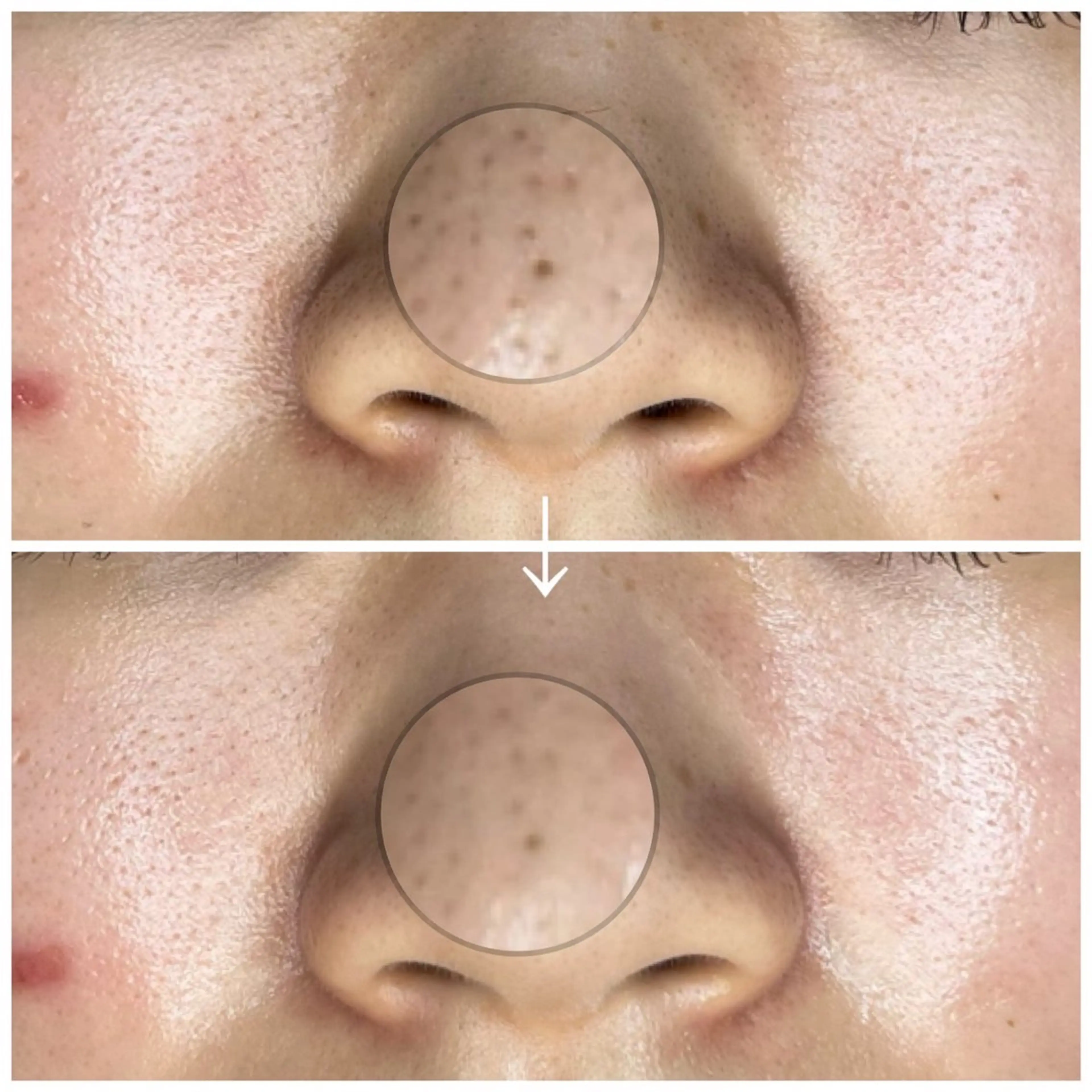 ROUN'　南 鈴沙のネイルデザイン