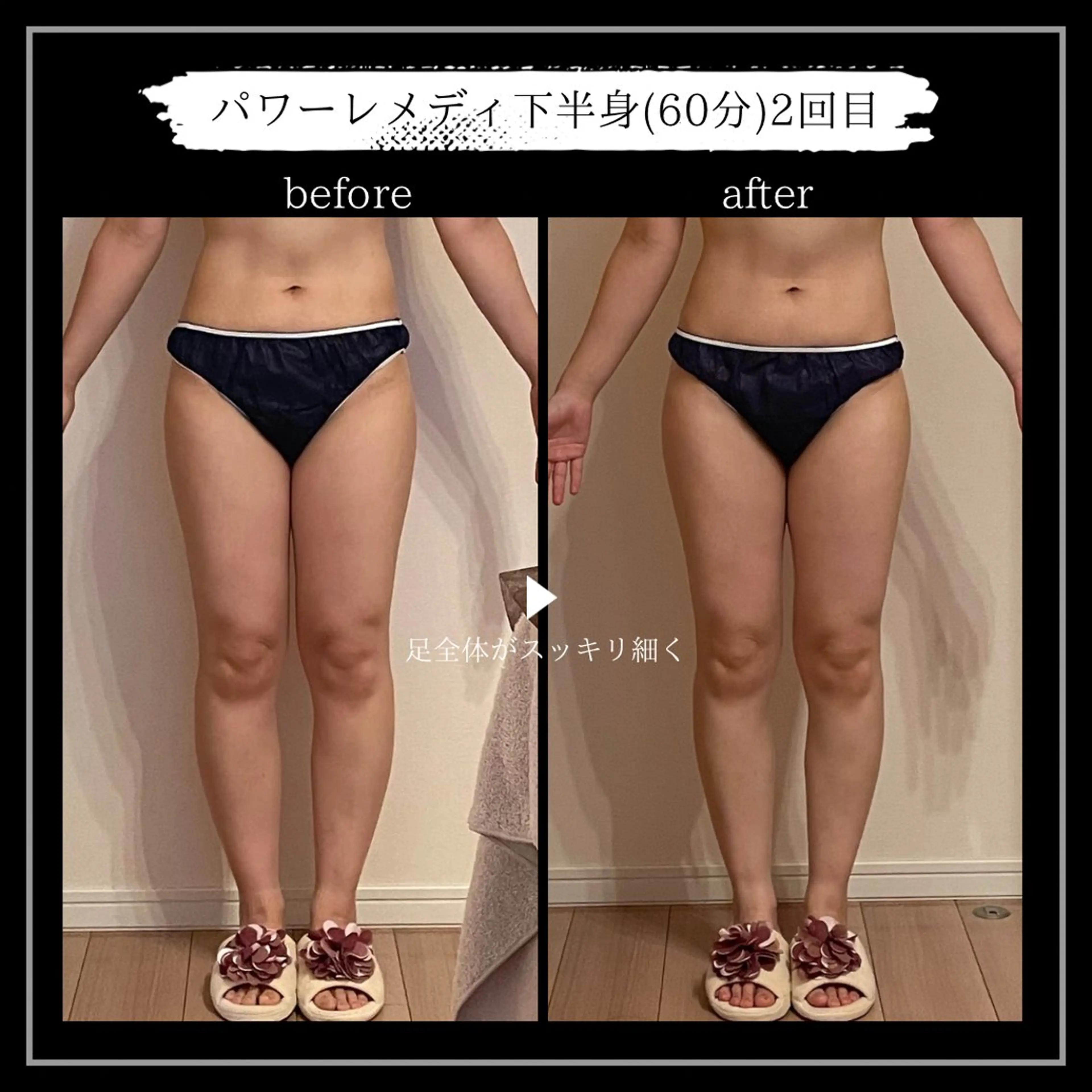 オフ:オン所属・オフ:オン 全身筋膜マッサージのエステ・リラクイメージ