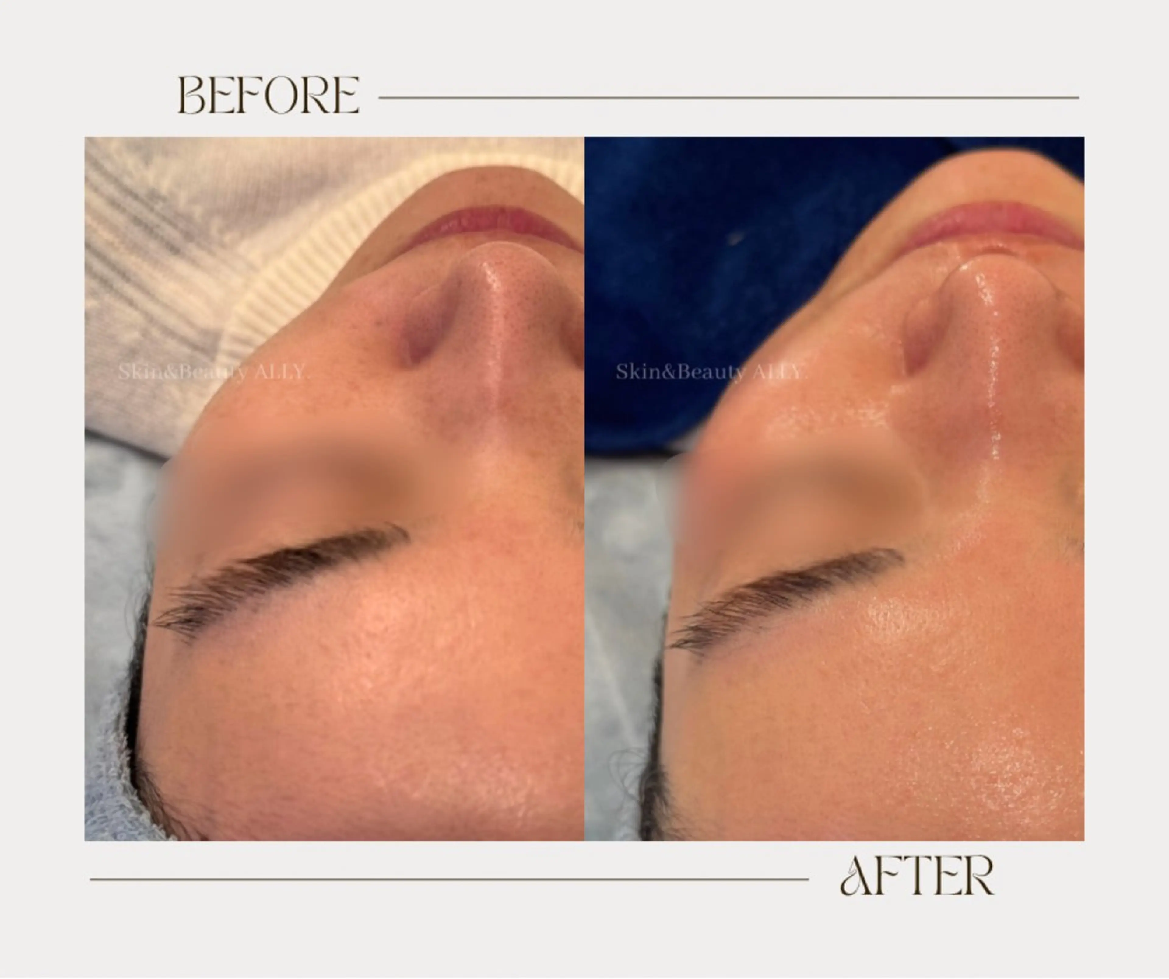 その他 艶肌ワックス ALLY.のエステ・リラクイメージ