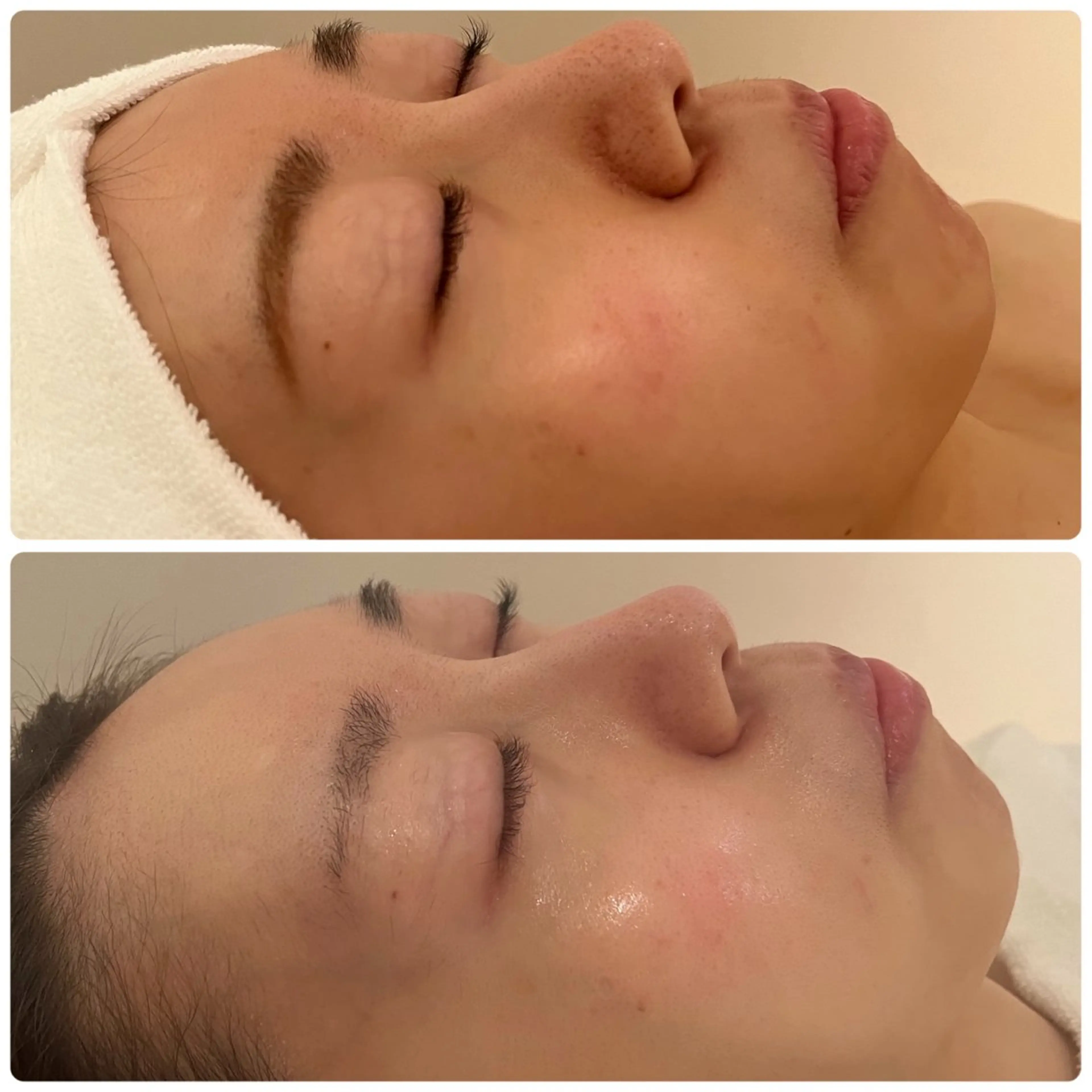 エステ ナリスビューティーサロン池袋店所属・スズキ マイのエステ・リラクイメージ