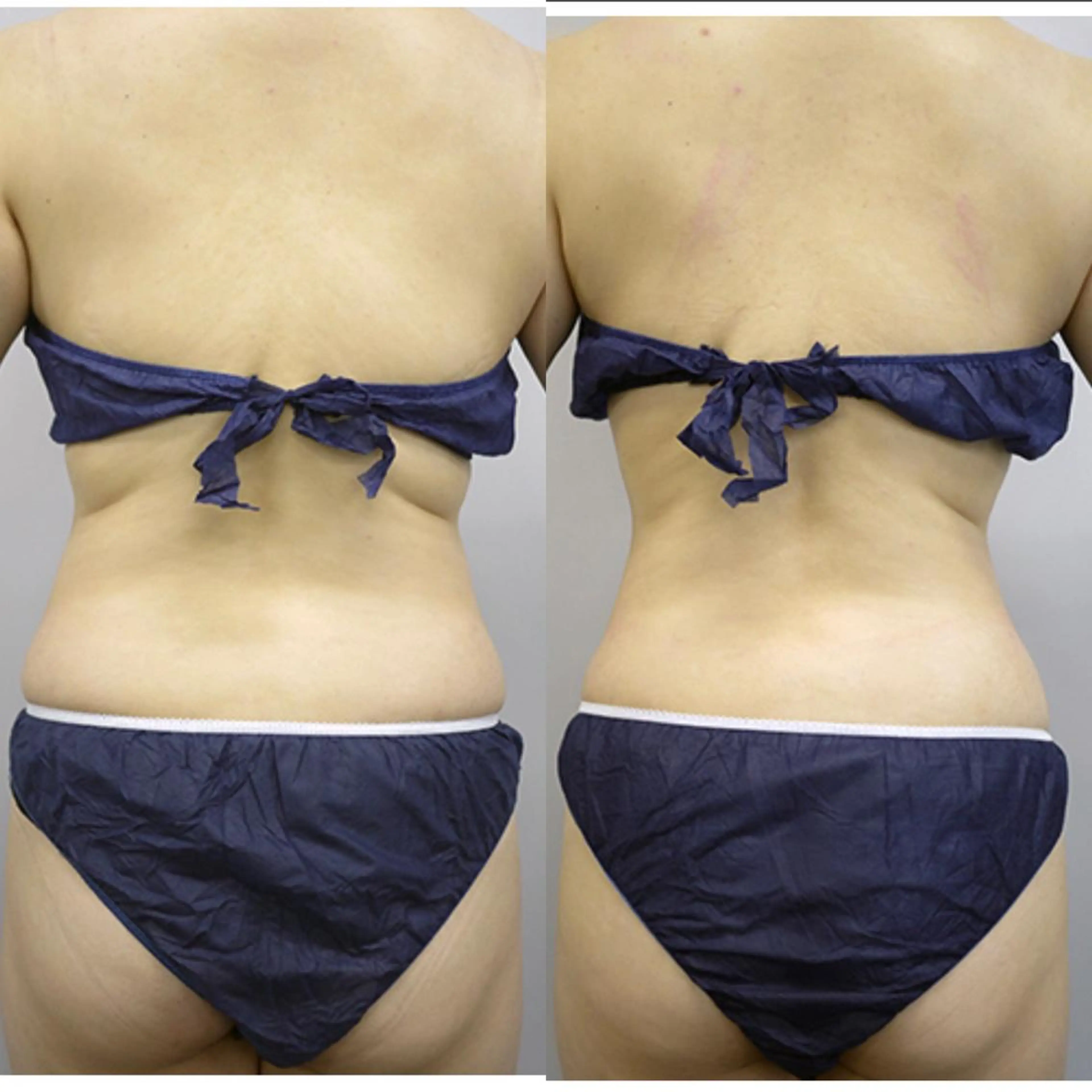 B againのエステ・リラクイメージ