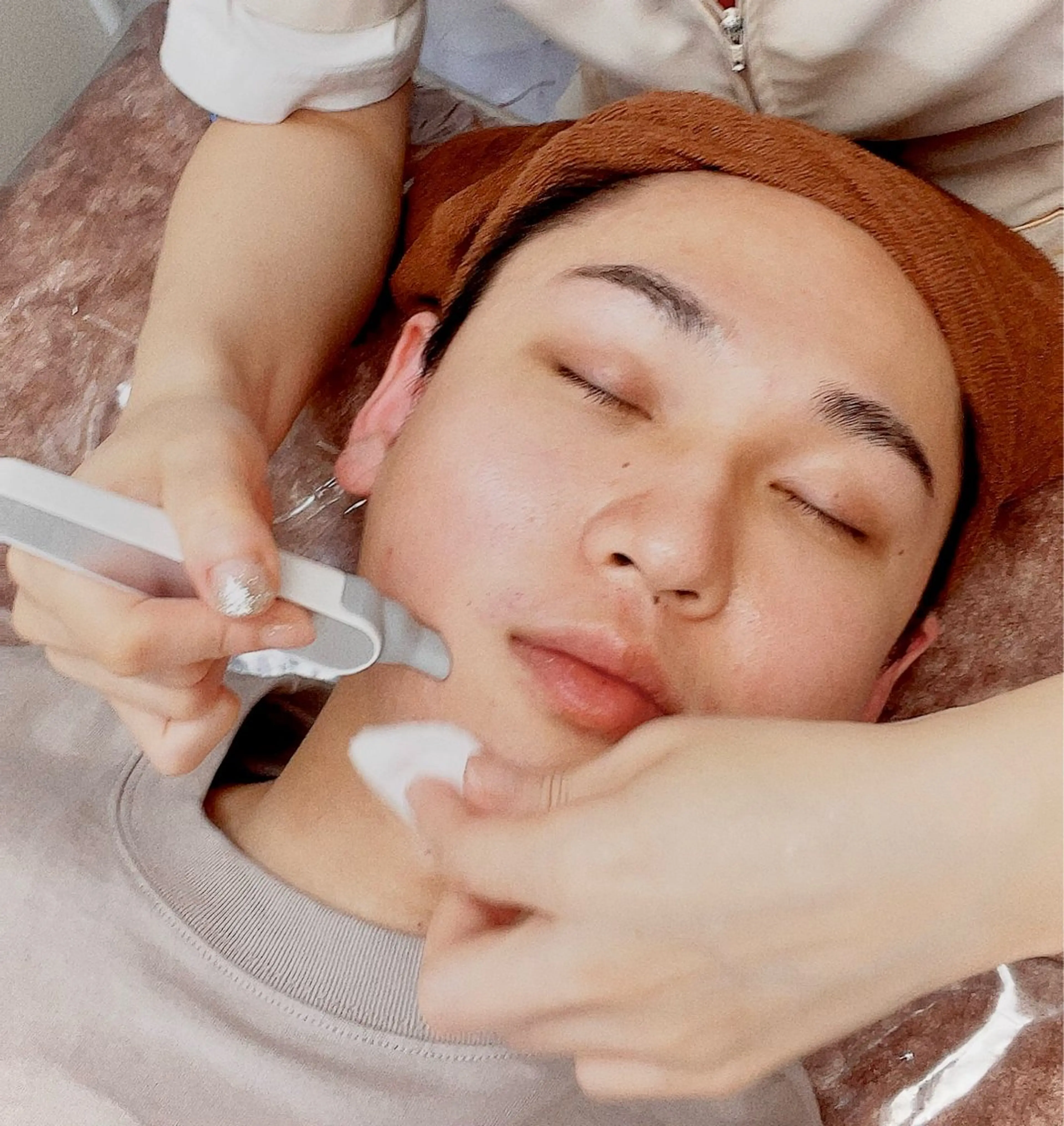 【毛穴ニキビ→美肌】メンズ毛穴洗浄ハイドラ＋ビタミンC導入＋3Dヒアルロン酸の写真