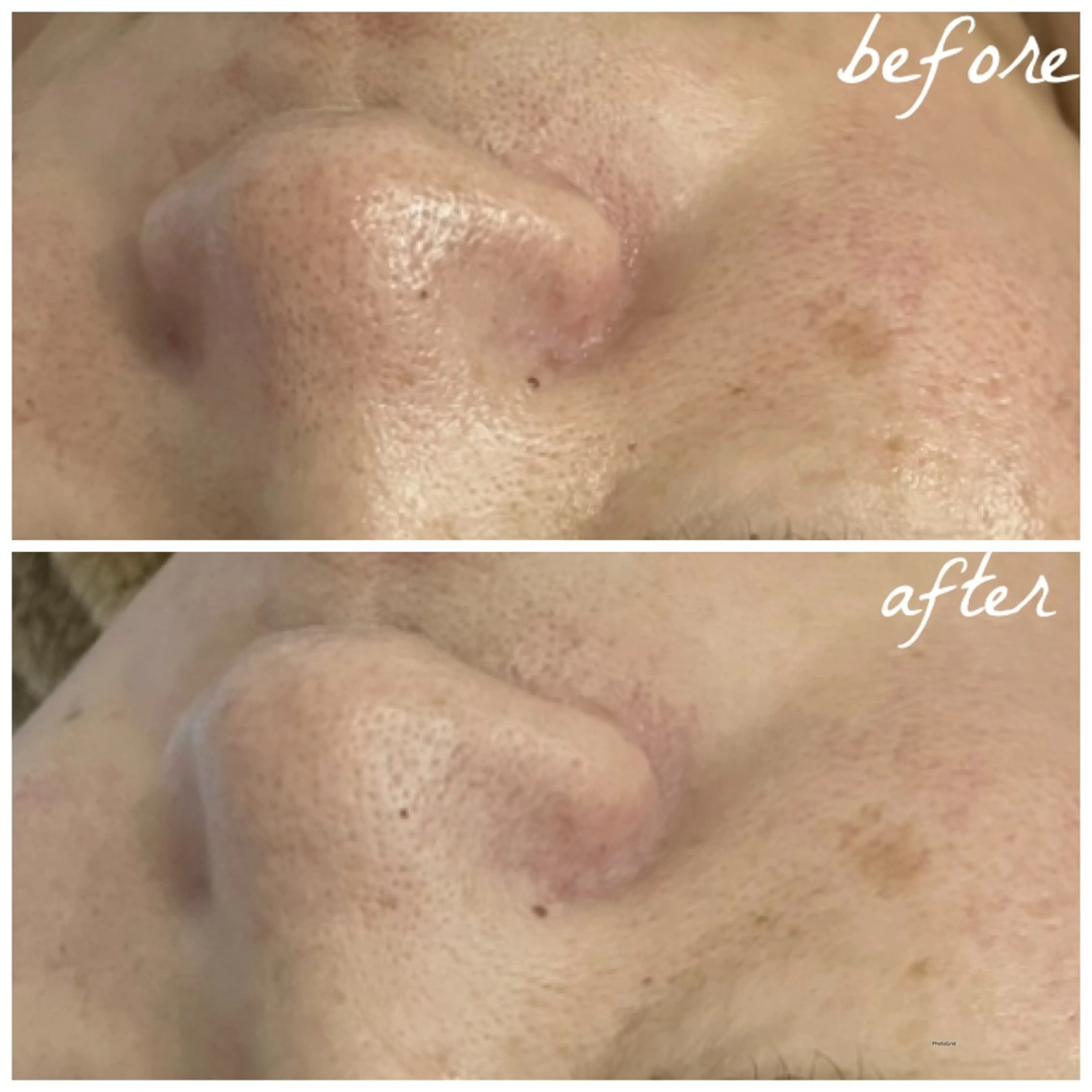 メンズ メナード岐阜茜部 杉浦のエステ・リラクイメージ