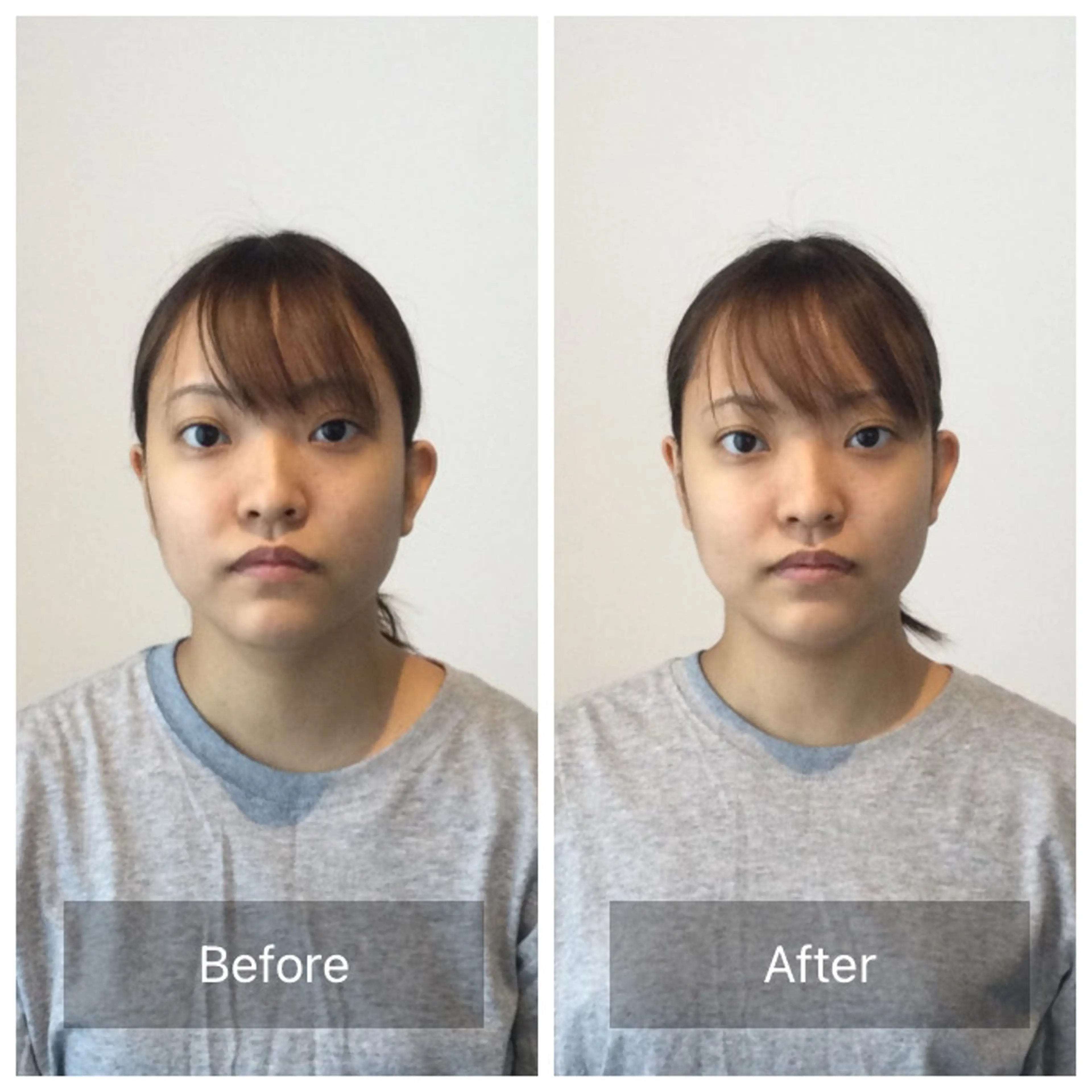 『施術後アンケート』ミニモ限定小顔ケアと骨盤ケア＋お悩み別OP50分¥15900-＜小顔解消/小顔姿勢/顔のバランス＞の写真