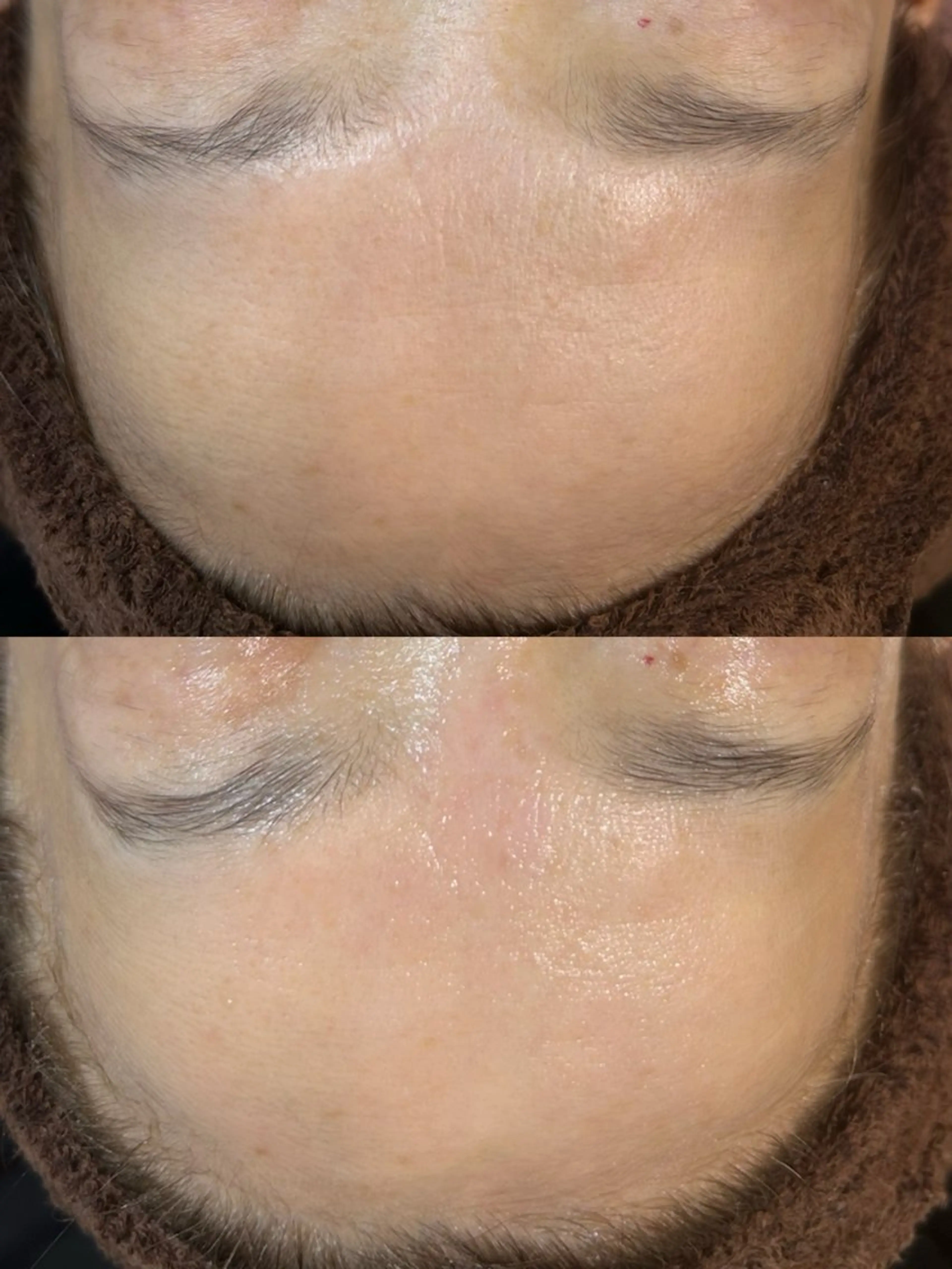 エステ beauty  salon sorelle所属・艶肌/角質ケア フェイシャルワックスのエステ・リラクイメージ