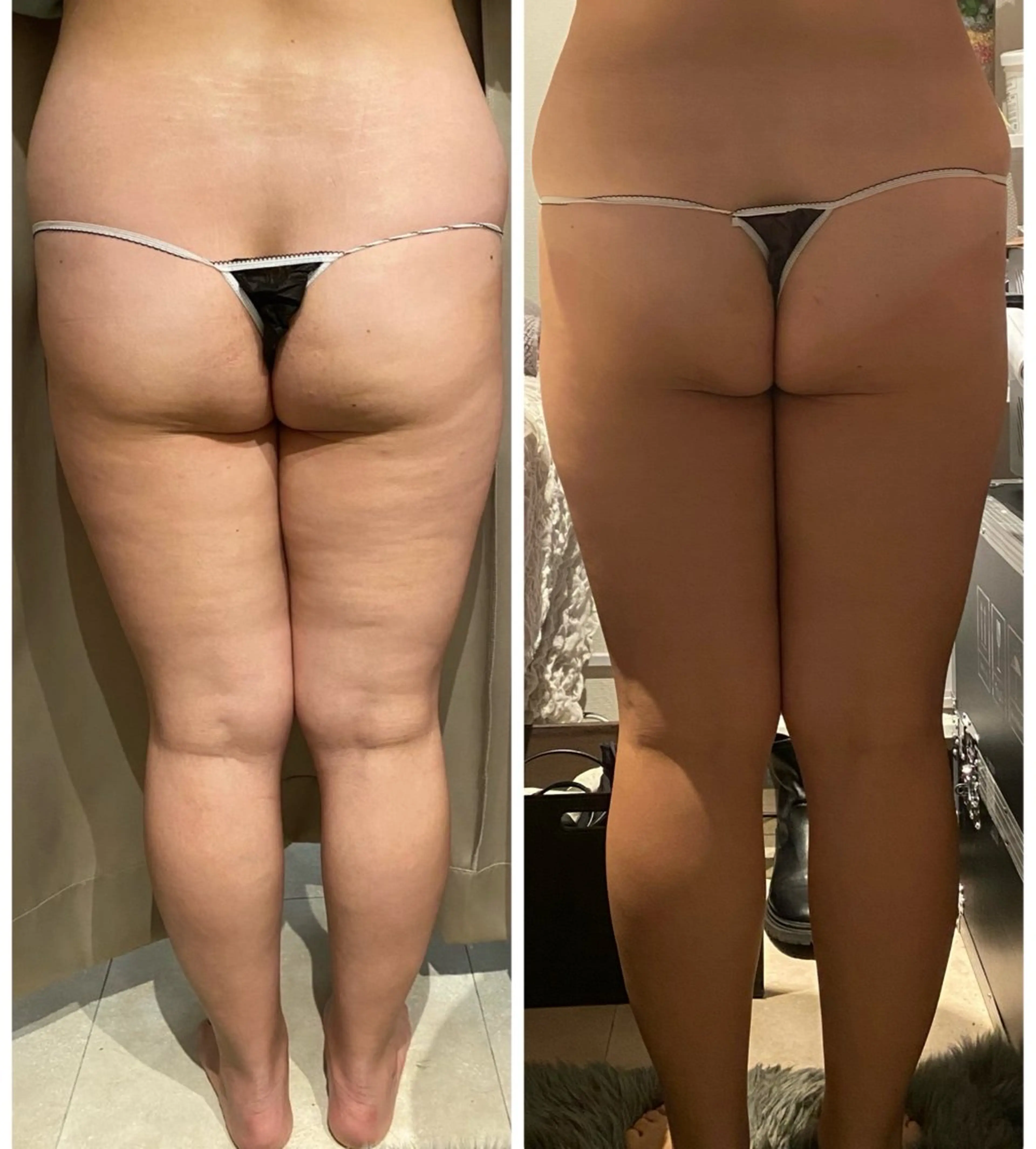 【痩身・脱毛サロン】 REBISKIN🌱のエステ・リラクイメージ