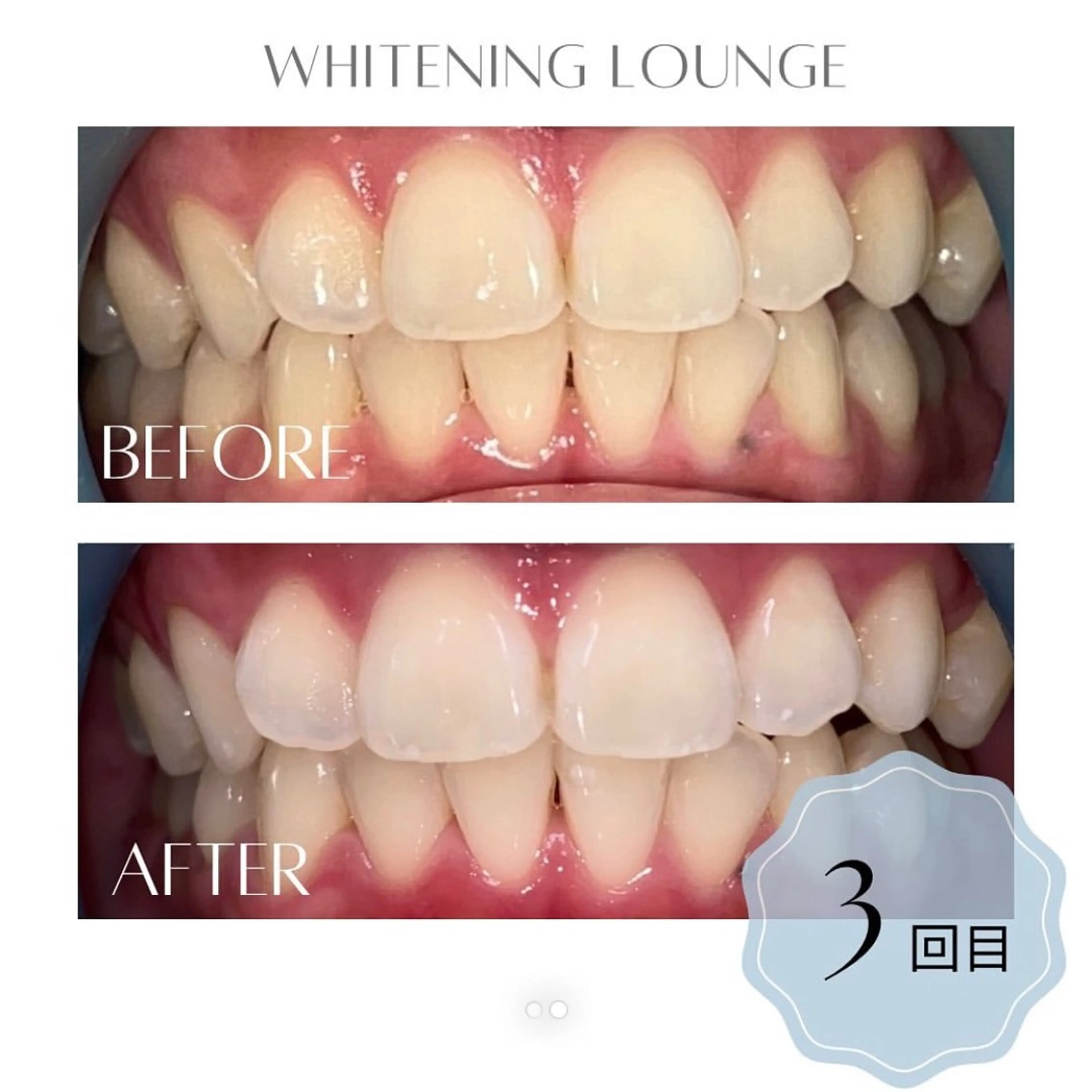 ホワイトニングラウンジ横須賀所属・ホワイトニング Lounge横須賀のその他イメージ