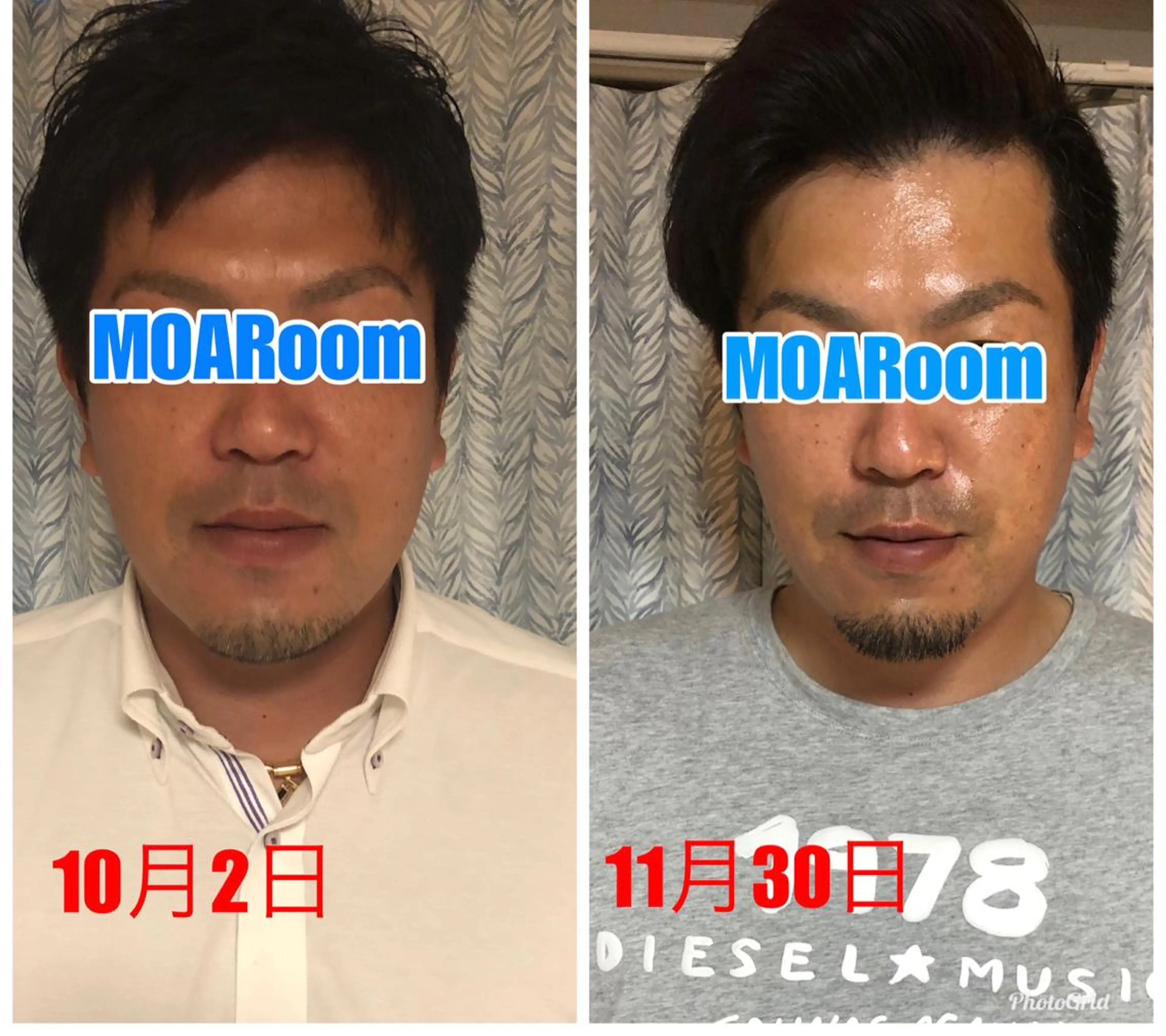メンズ エステ MOARoom所属・毛利 明代のエステ・リラクイメージ