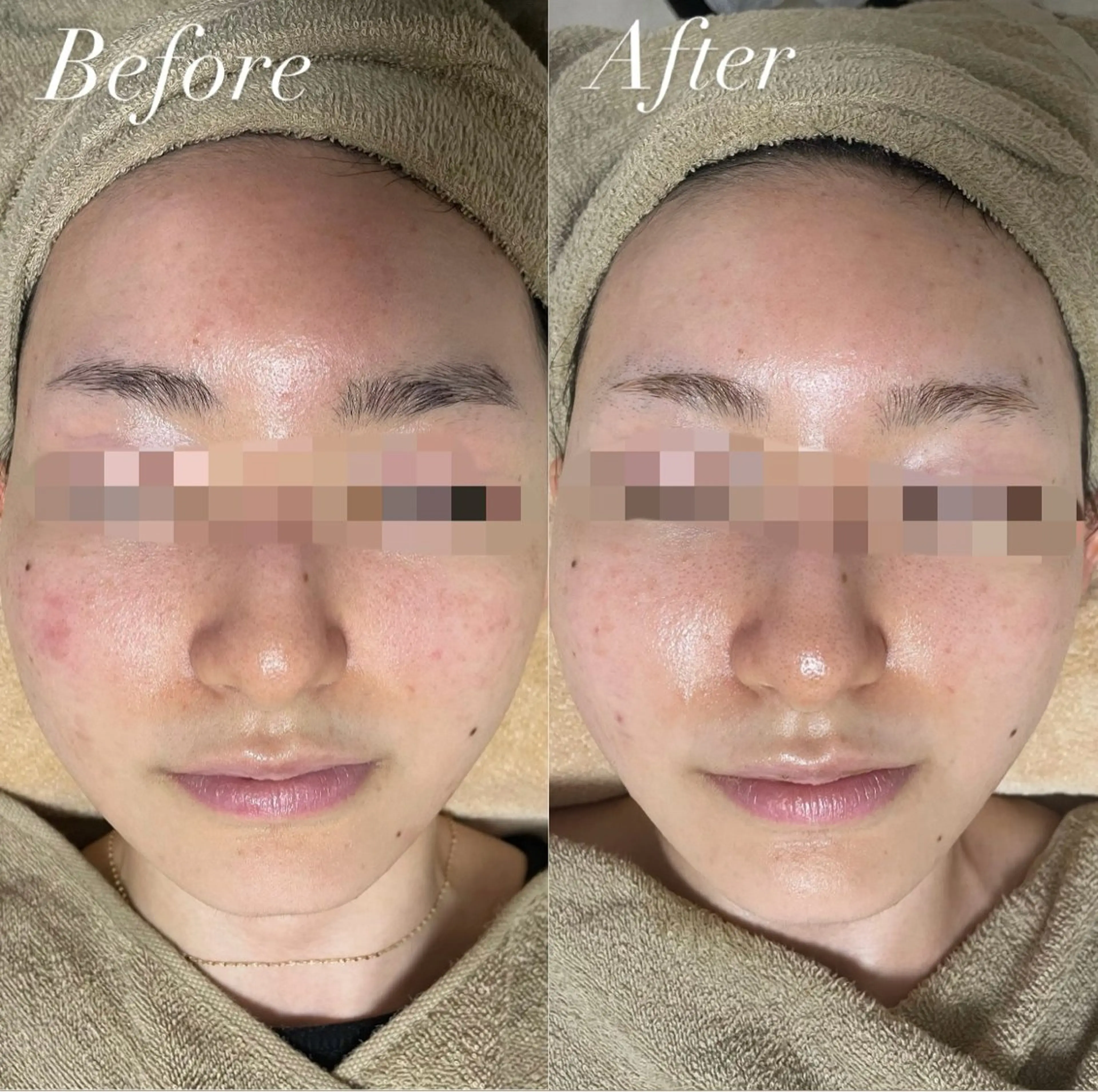 エステ プライベートサロン Belle（ベル）のエステ・リラクイメージ