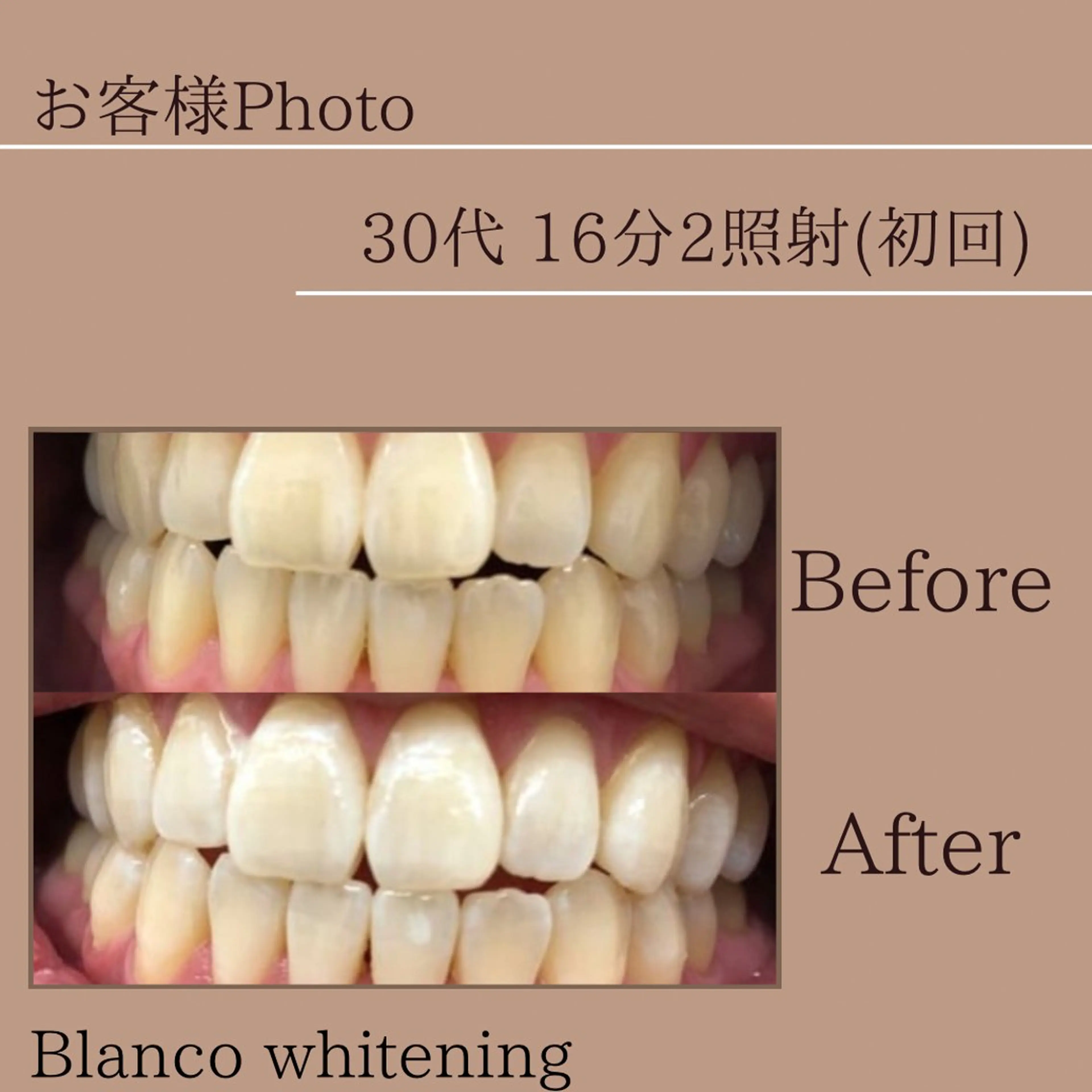 Blanco東大宮駅前店所属・blanco 東大宮駅前店のその他イメージ