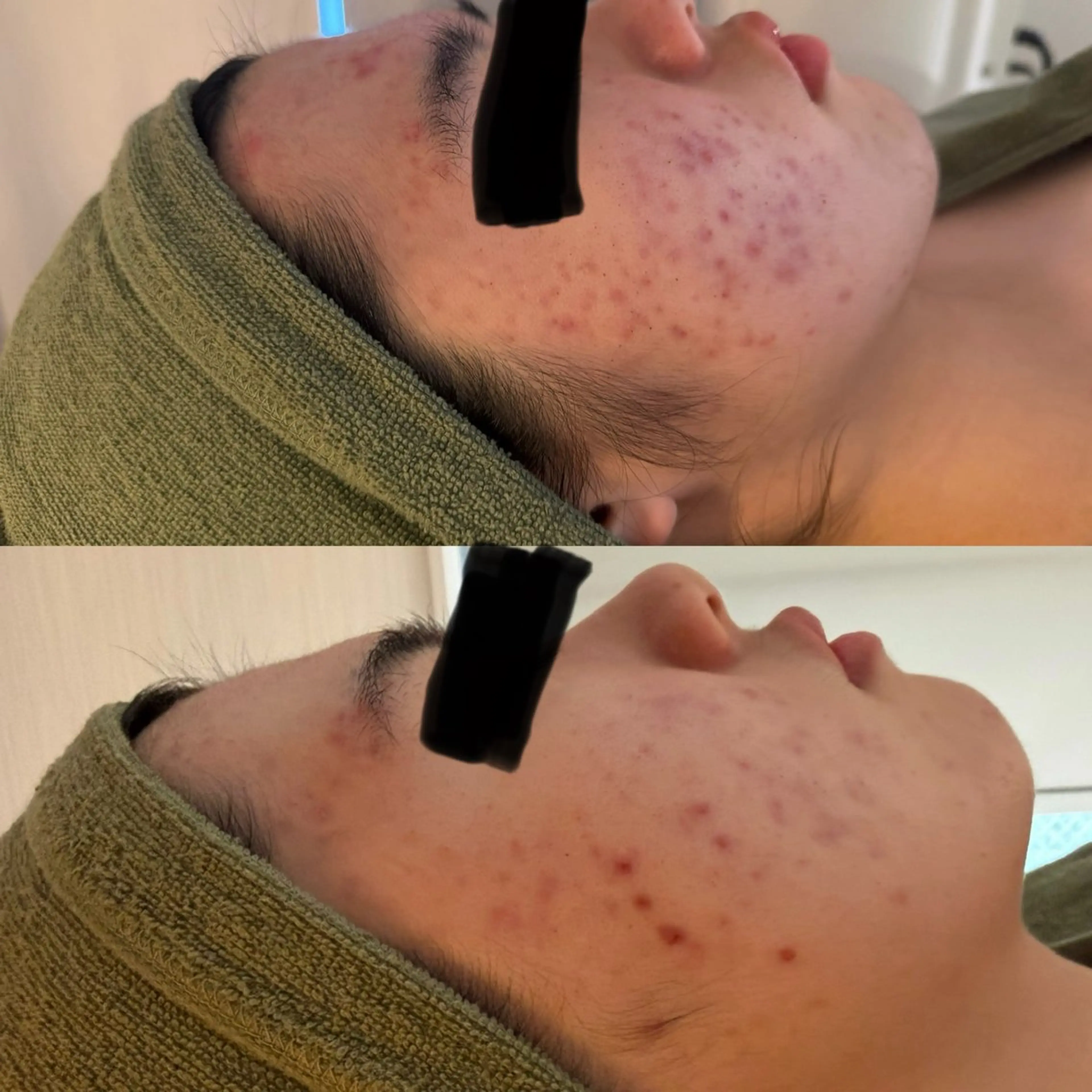 エステ よもぎ蒸しサロンc.iエステティック所属・睡眠の質／体質改善 c.iエステティックのエステ・リラクイメージ