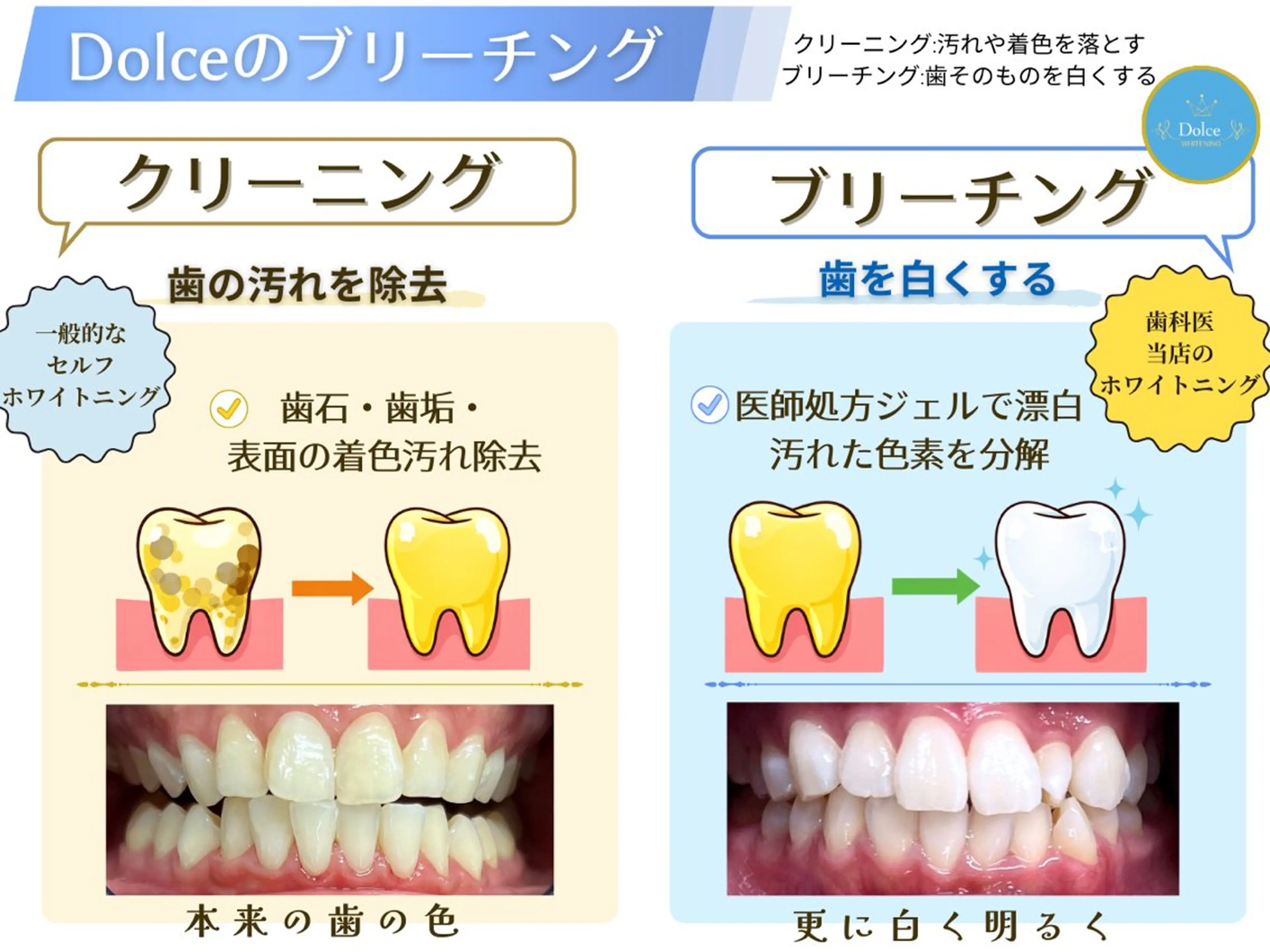 セルフホワイトニング Dolce水戸店のその他イメージ