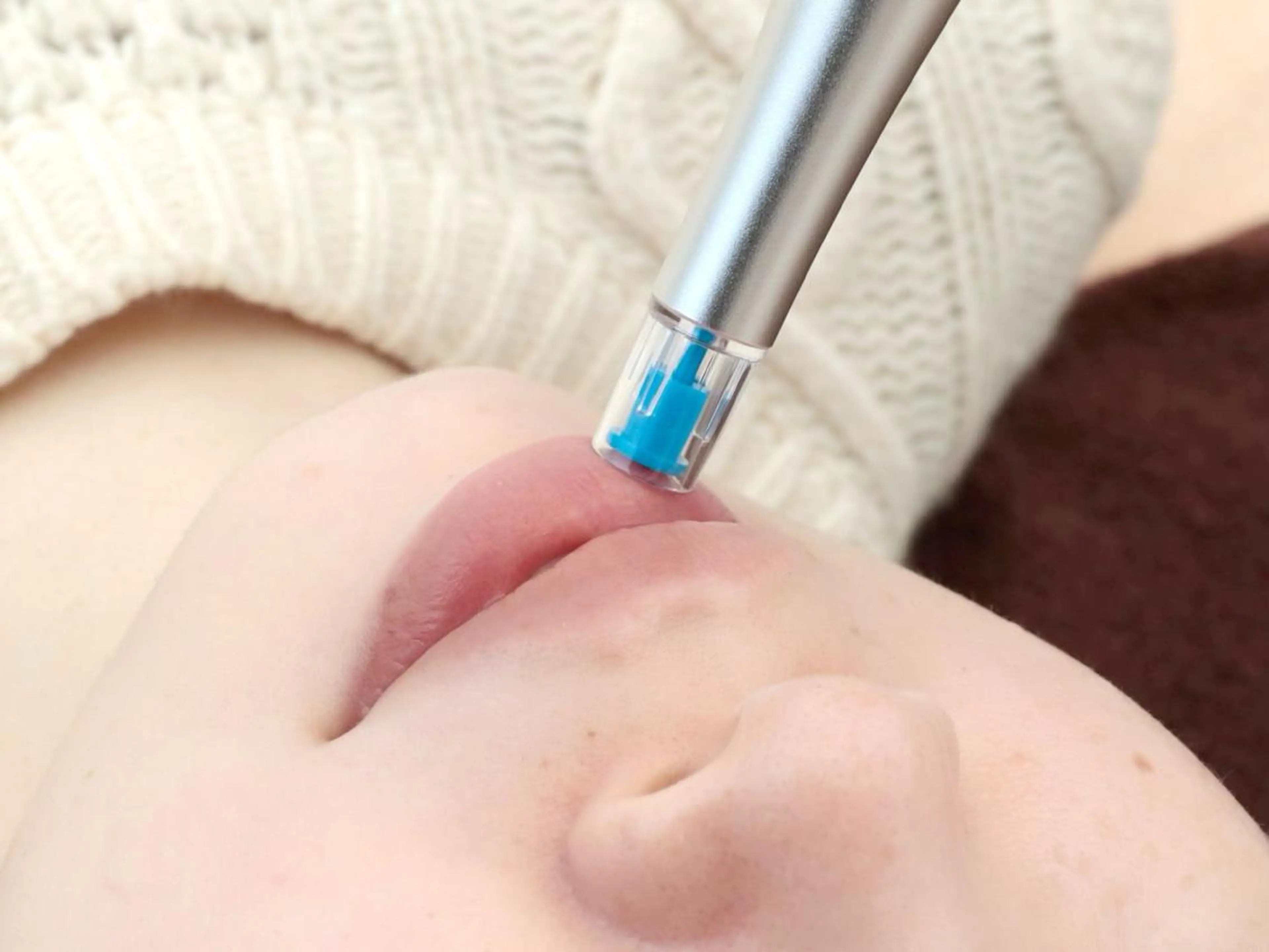 【リピート割20%オフ】エステ版ダーマペン🖋リゼネレート✨痛み･赤み･ダウンタイムなし/目元･唇にも施術OK❗️の写真