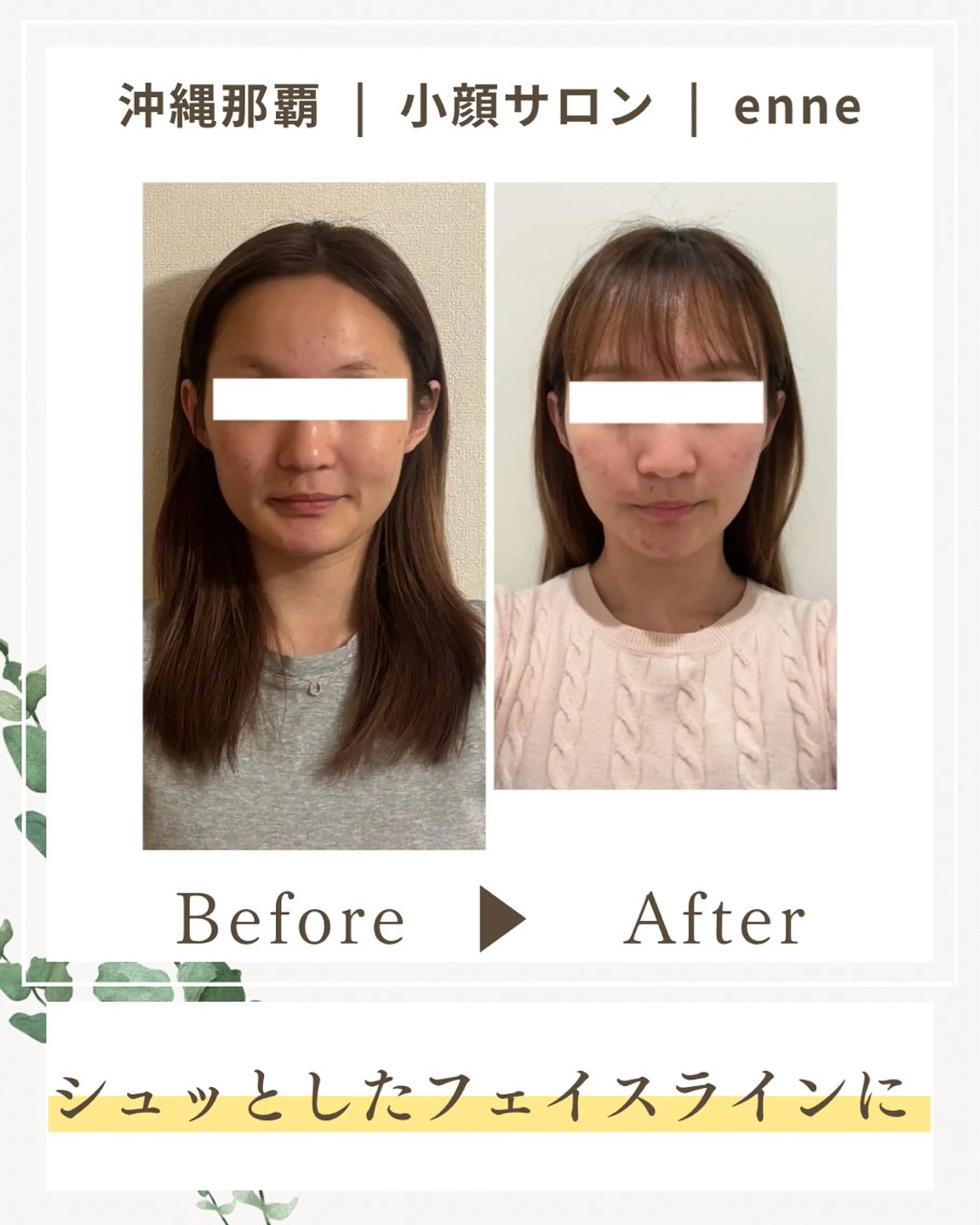 その他 小顔サロンenne所属・小顔サロンenne 【エンネ】のその他イメージ