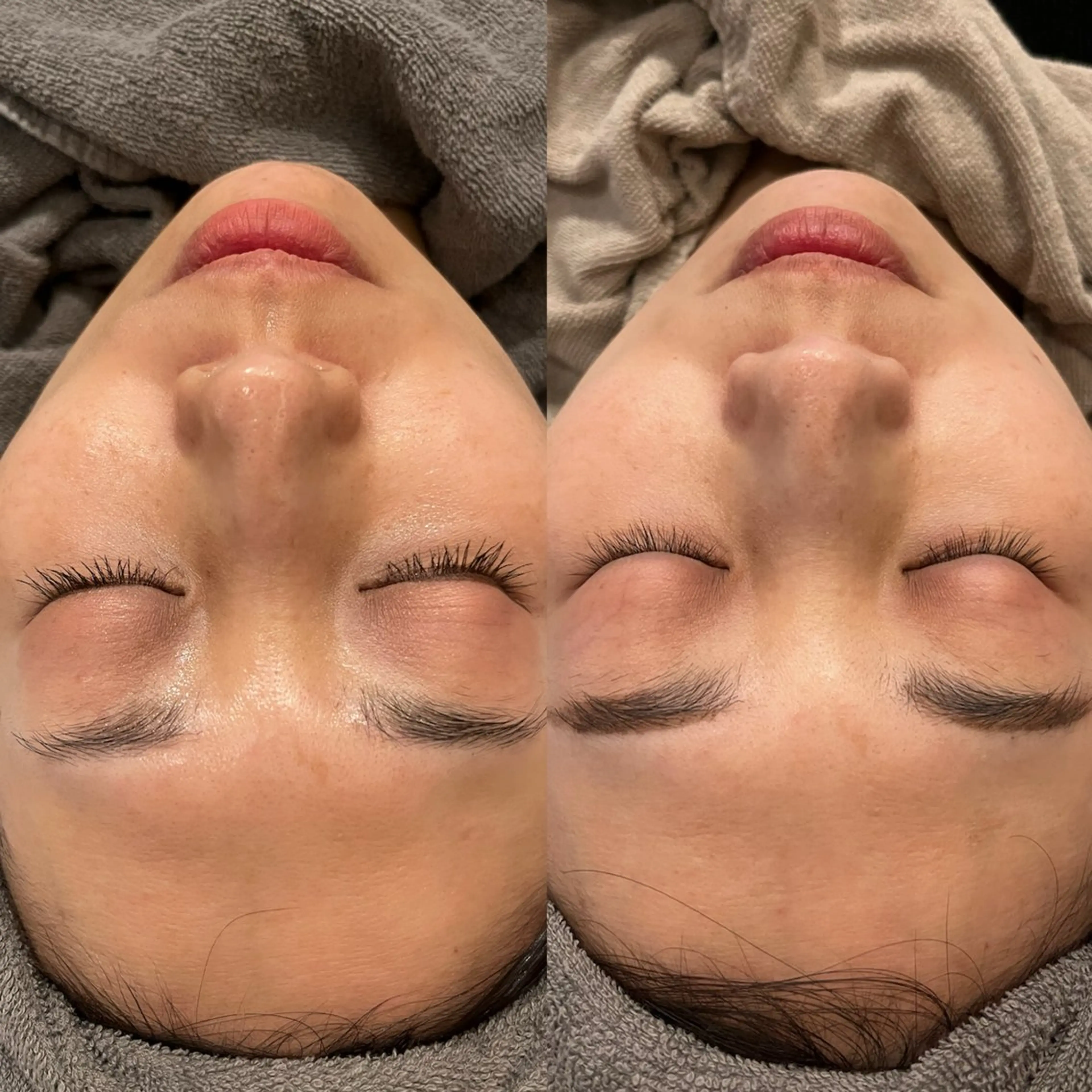 その他 yellow.所属・yellow💛【 脱毛&フェイシャル】のエステ・リラクイメージ