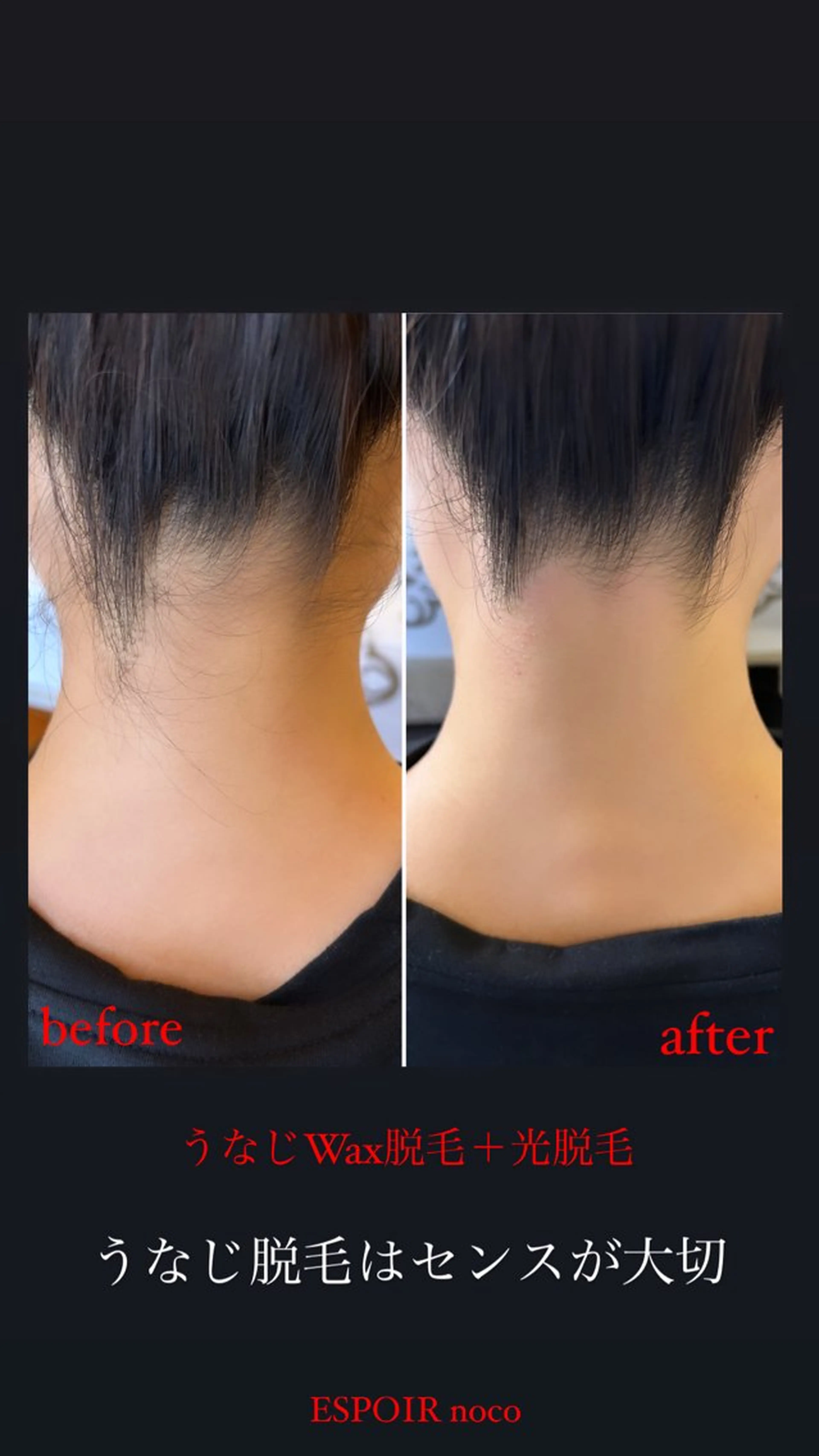 ワックス脱毛🌈 ESPOIRnocoのエステ・リラクイメージ