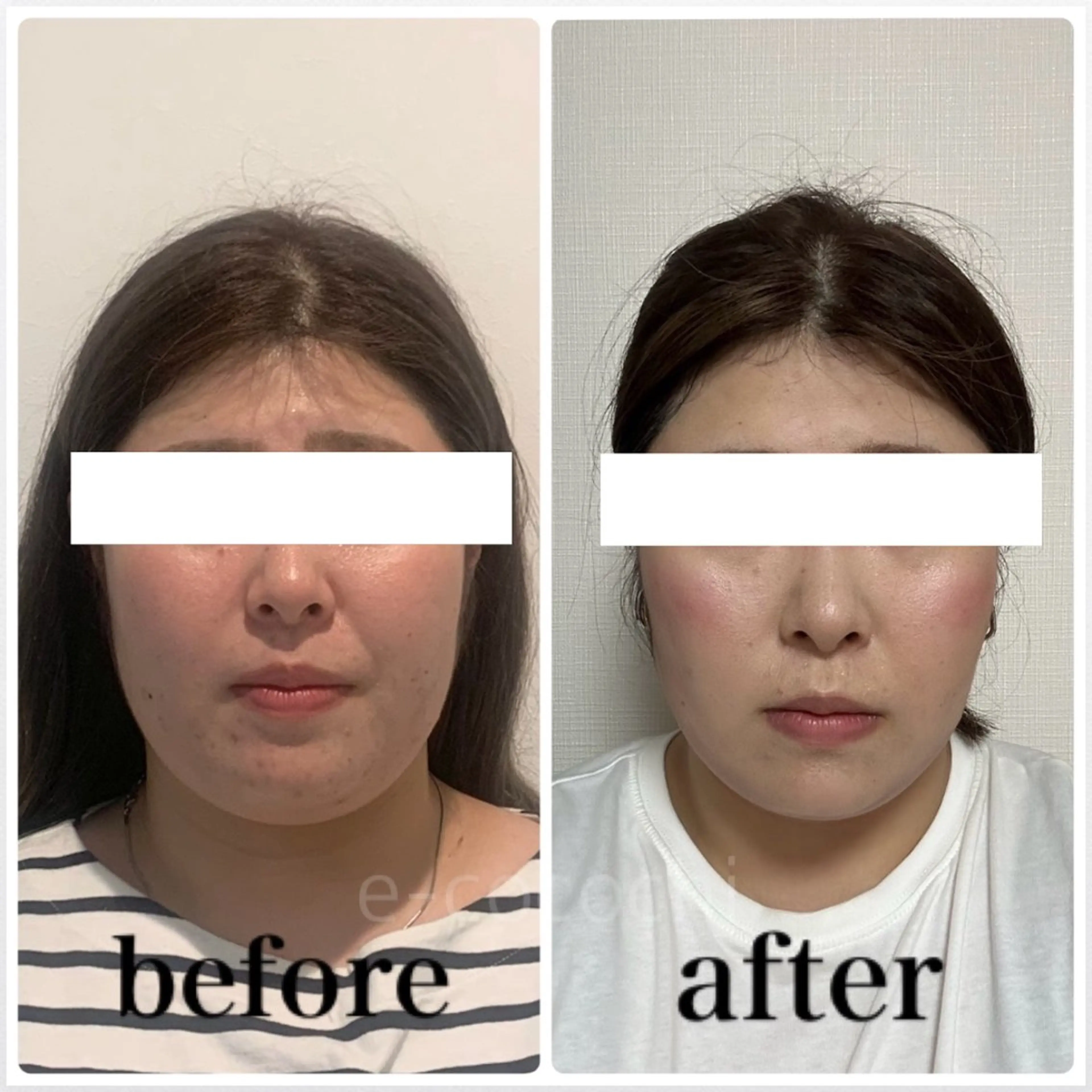 エステ リラク 小顔と ヘッドスパのお店のエステ・リラクイメージ