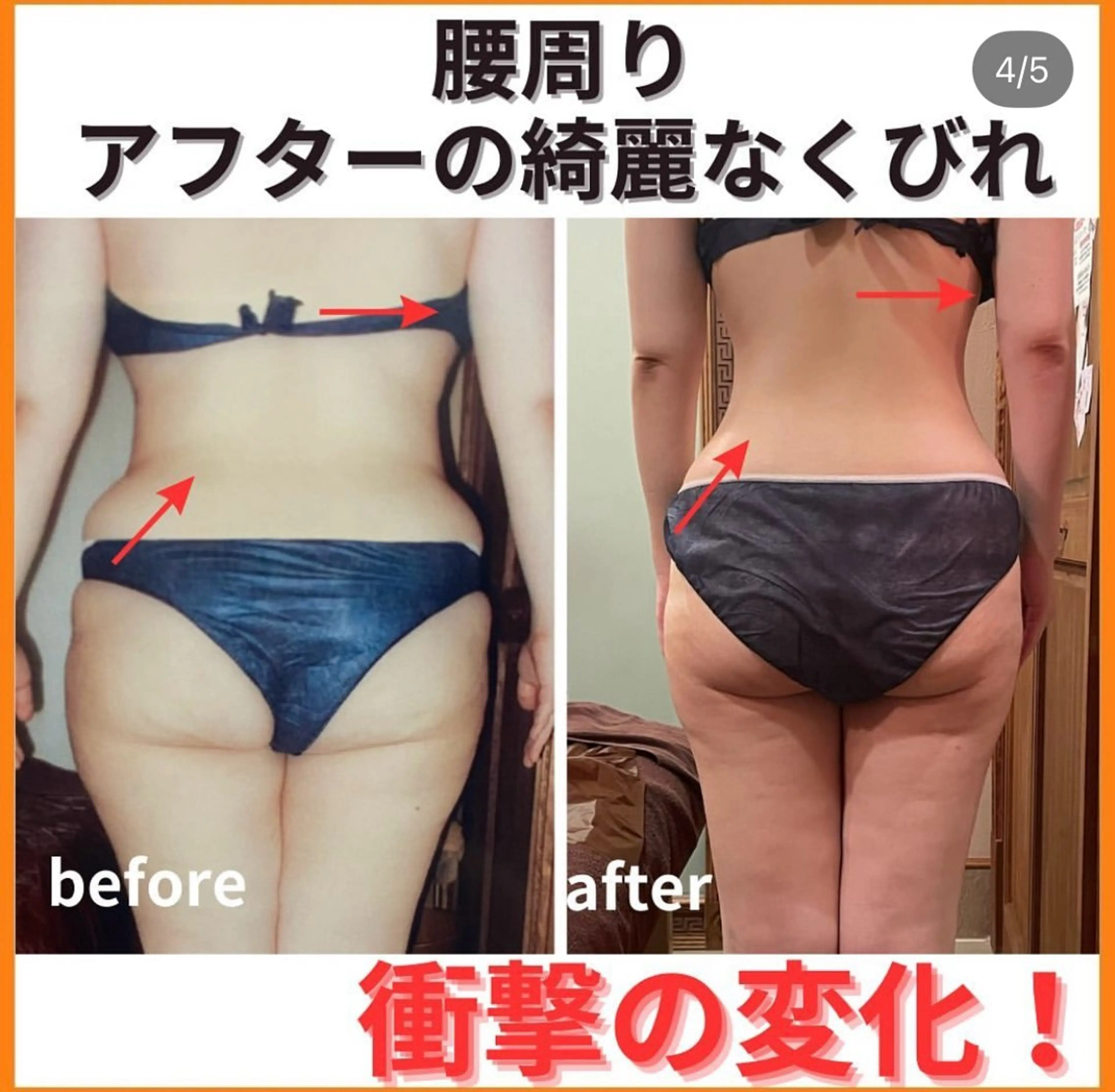 エステ 痩身&美肌サロン 三浦のその他イメージ