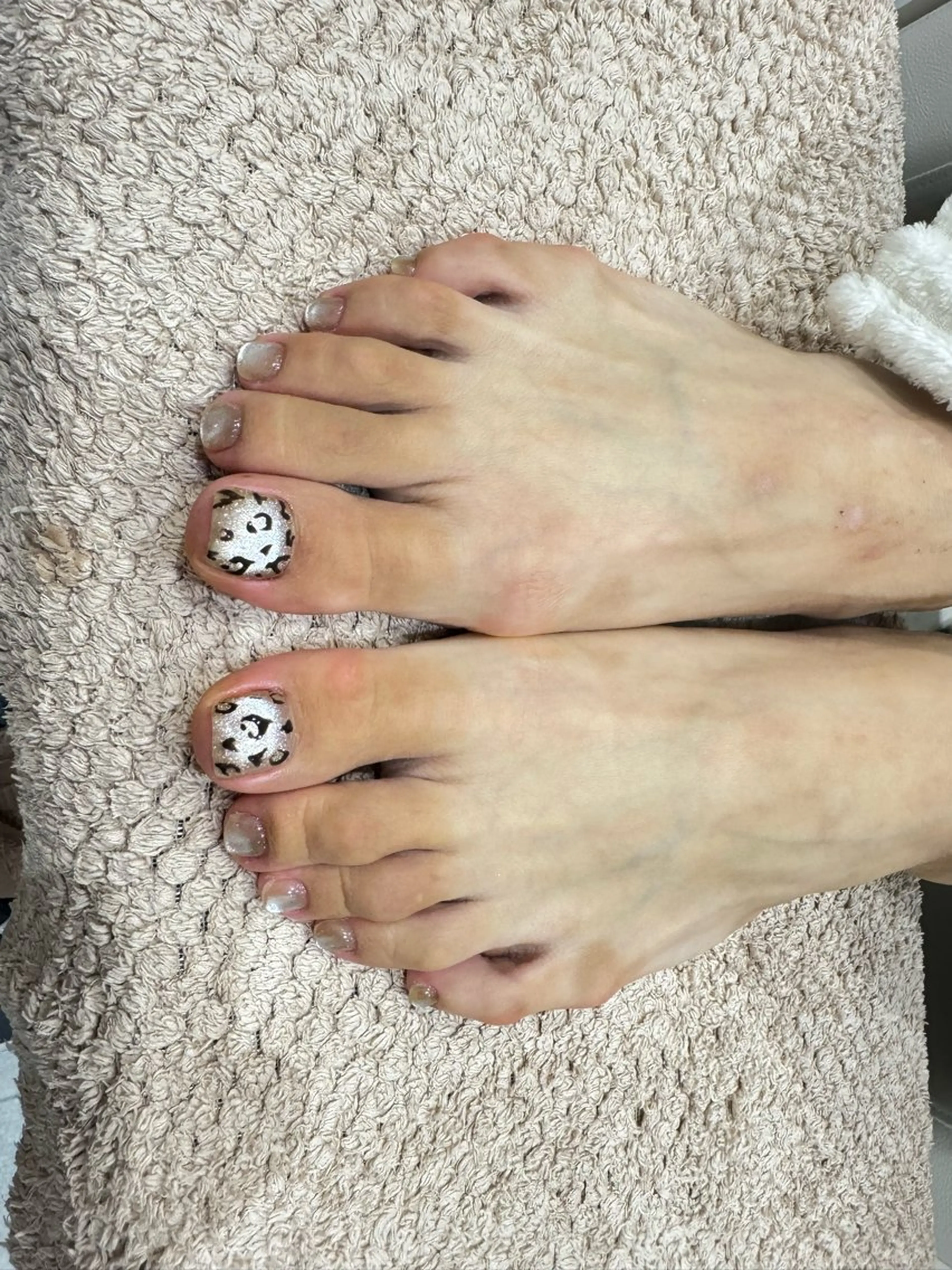 フット2本アート(オフあり)の写真