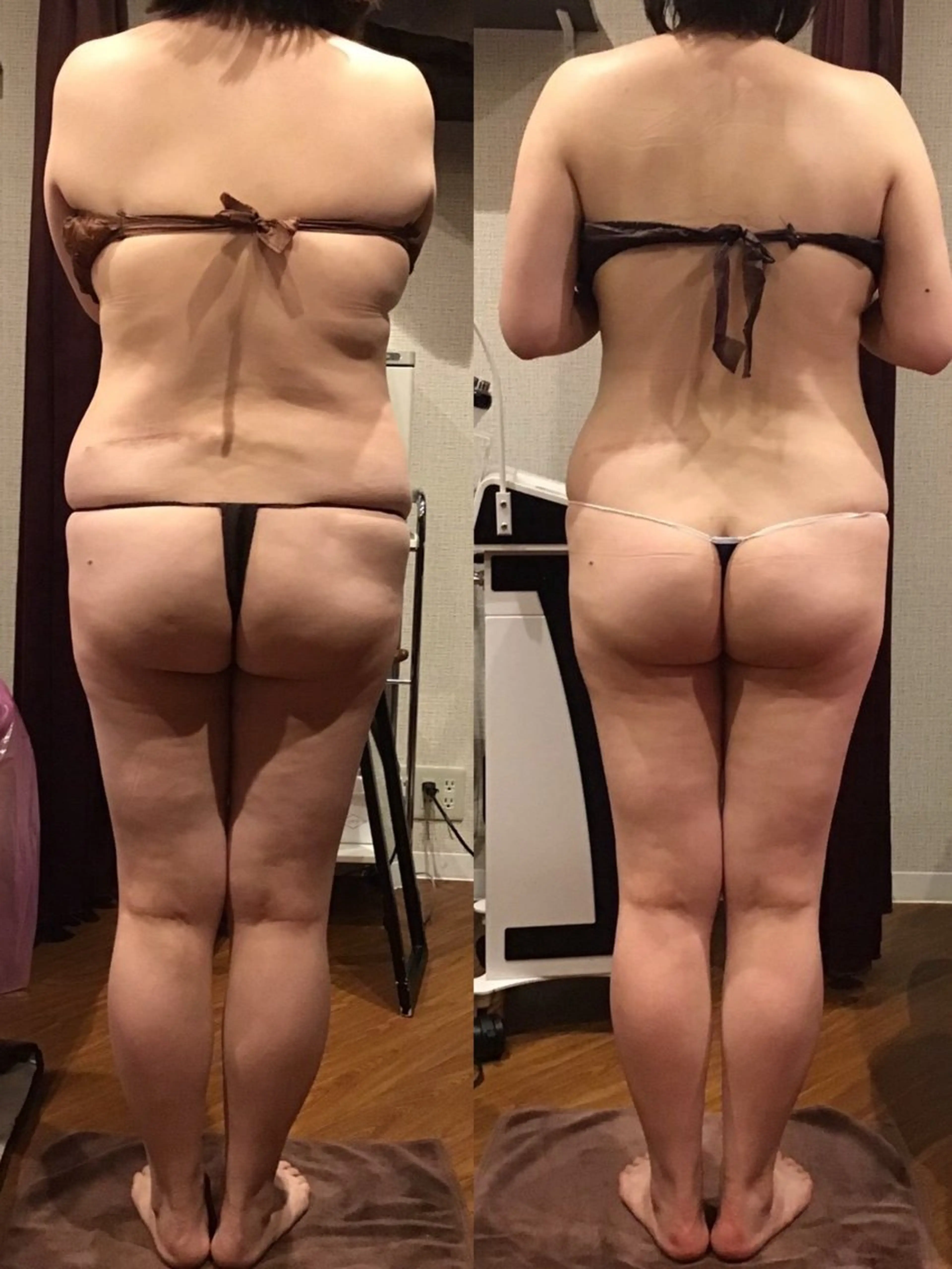 エステ リラク espresso,所属・《痩身、小顔専門店》 エスプレッソのエステ・リラクイメージ