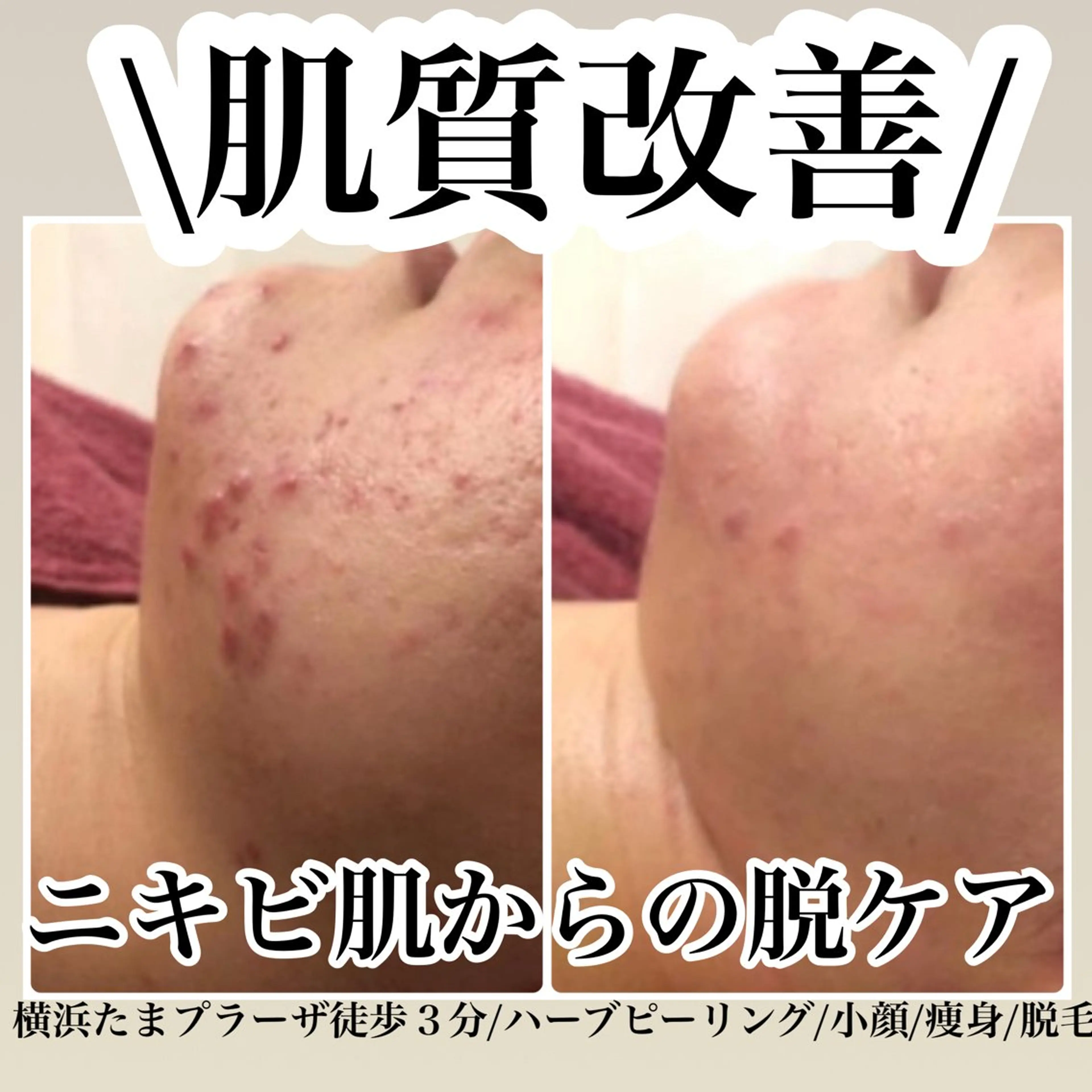 LILIANA所属・LILIANA ☆YURIのエステ・リラクイメージ