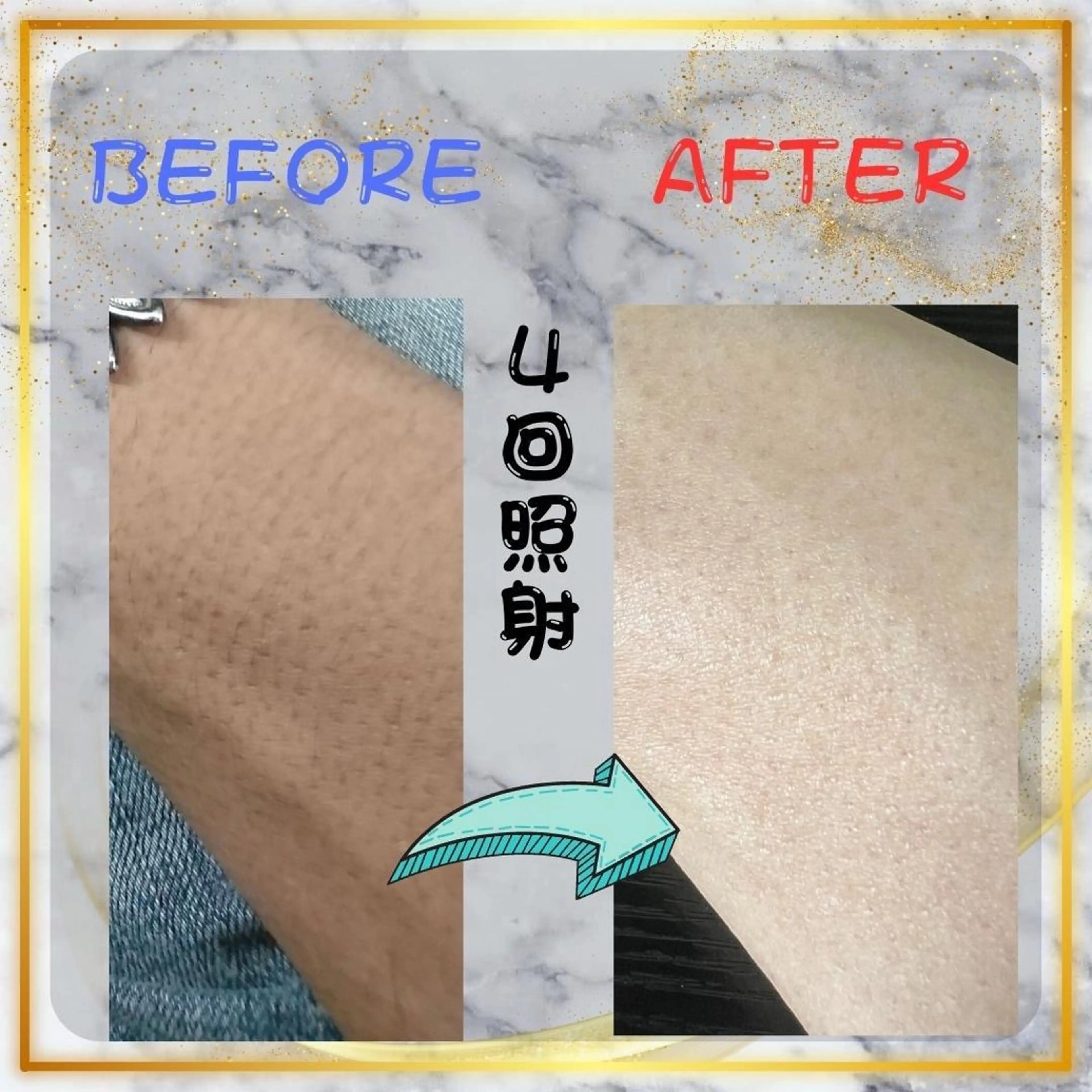 メンズ キッズ 脱毛 メンズ脱毛　FELISSE【フェリッセ】所属・メンズ脱毛フェリッセ /男女🆗キッズ🆗のエステ・リラクイメージ