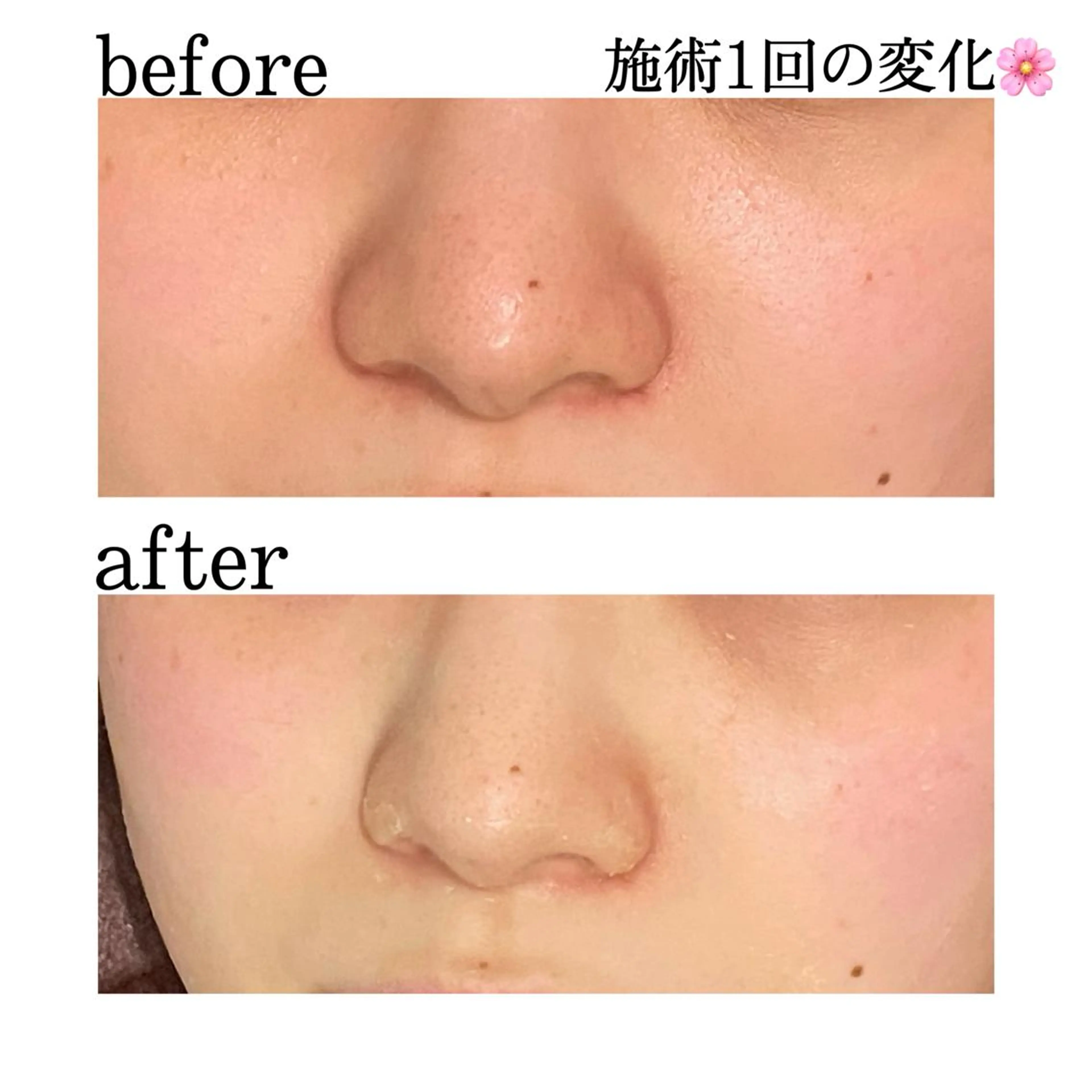 触れたくなる モテ肌へ...❤︎のエステ・リラクイメージ