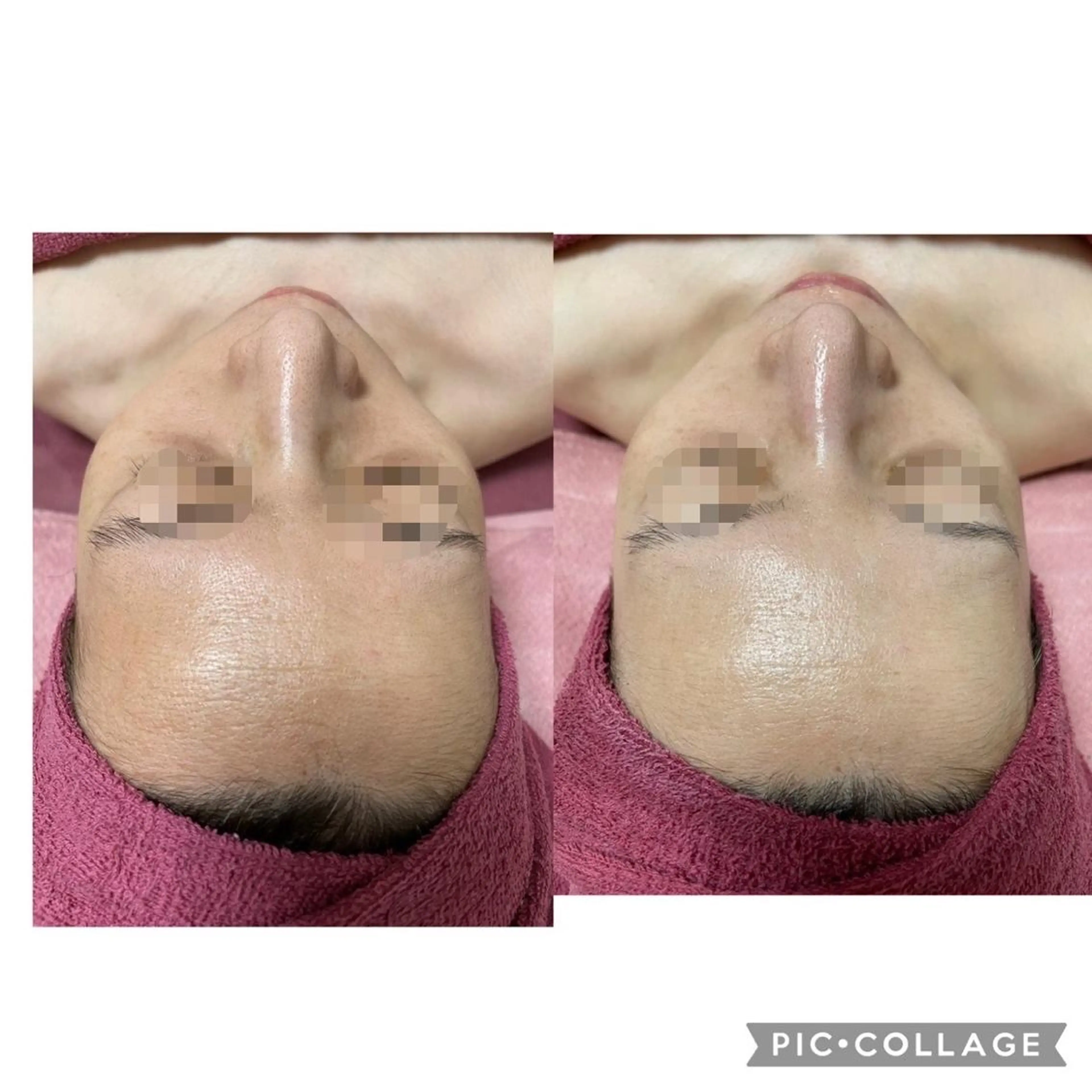 エステ 伊藤 順子のその他イメージ