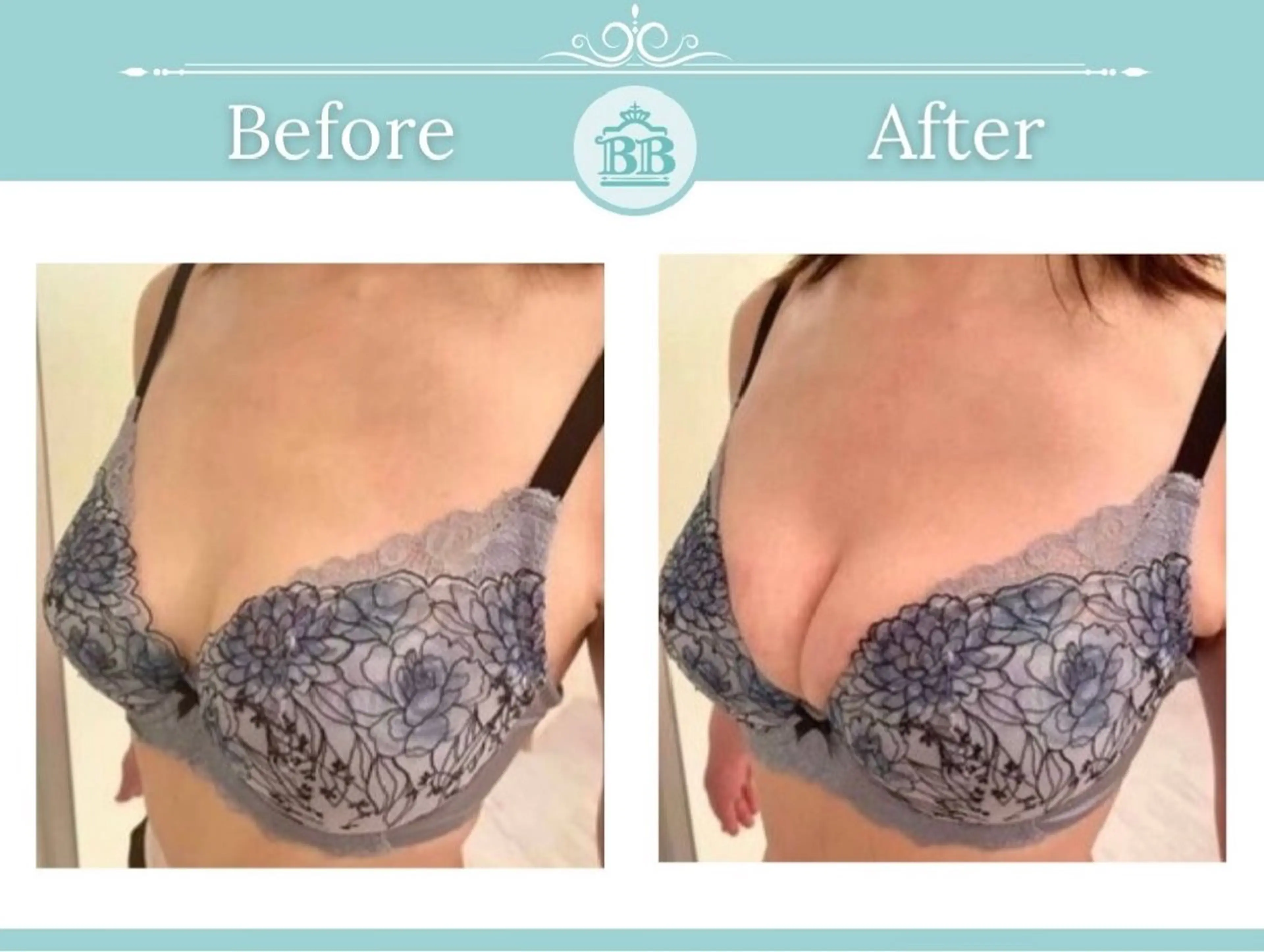 エステ 美人バスト本厚木店所属・美人バスト 本厚木店のエステ・リラクイメージ