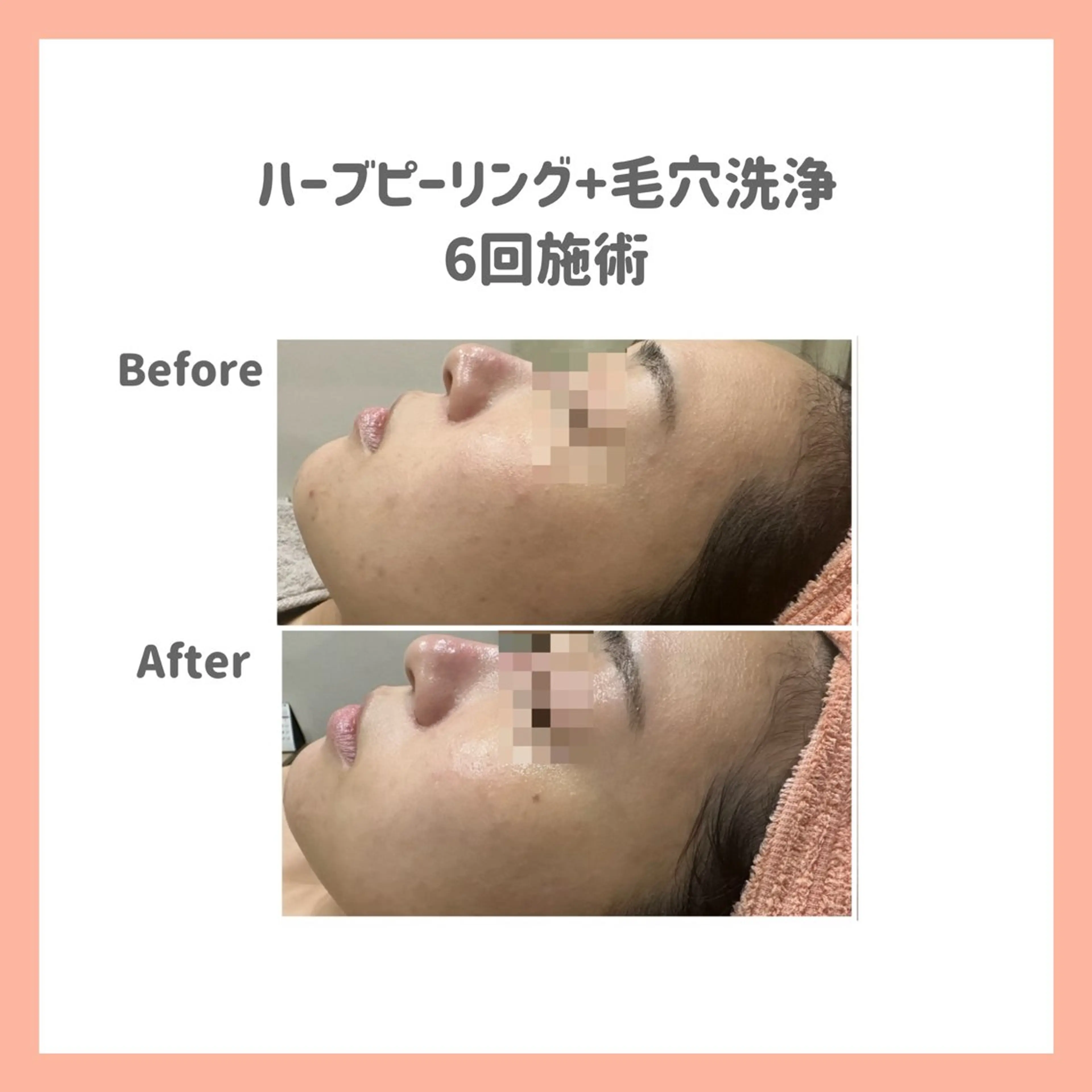 ハーブピーリング専門 muro.のエステ・リラクイメージ