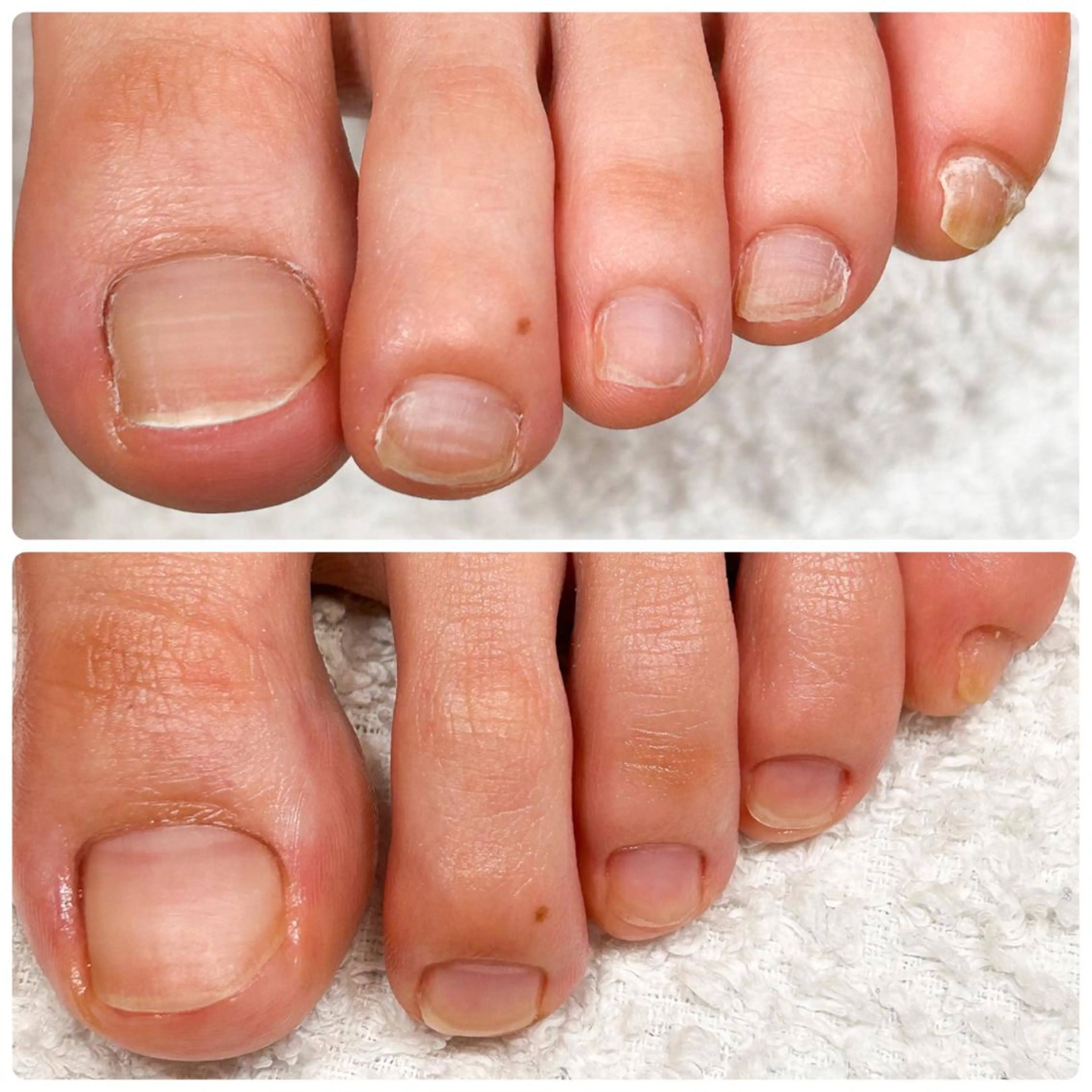 ネイル ケアが得意なサロン Happinailのエステ・リラクイメージ