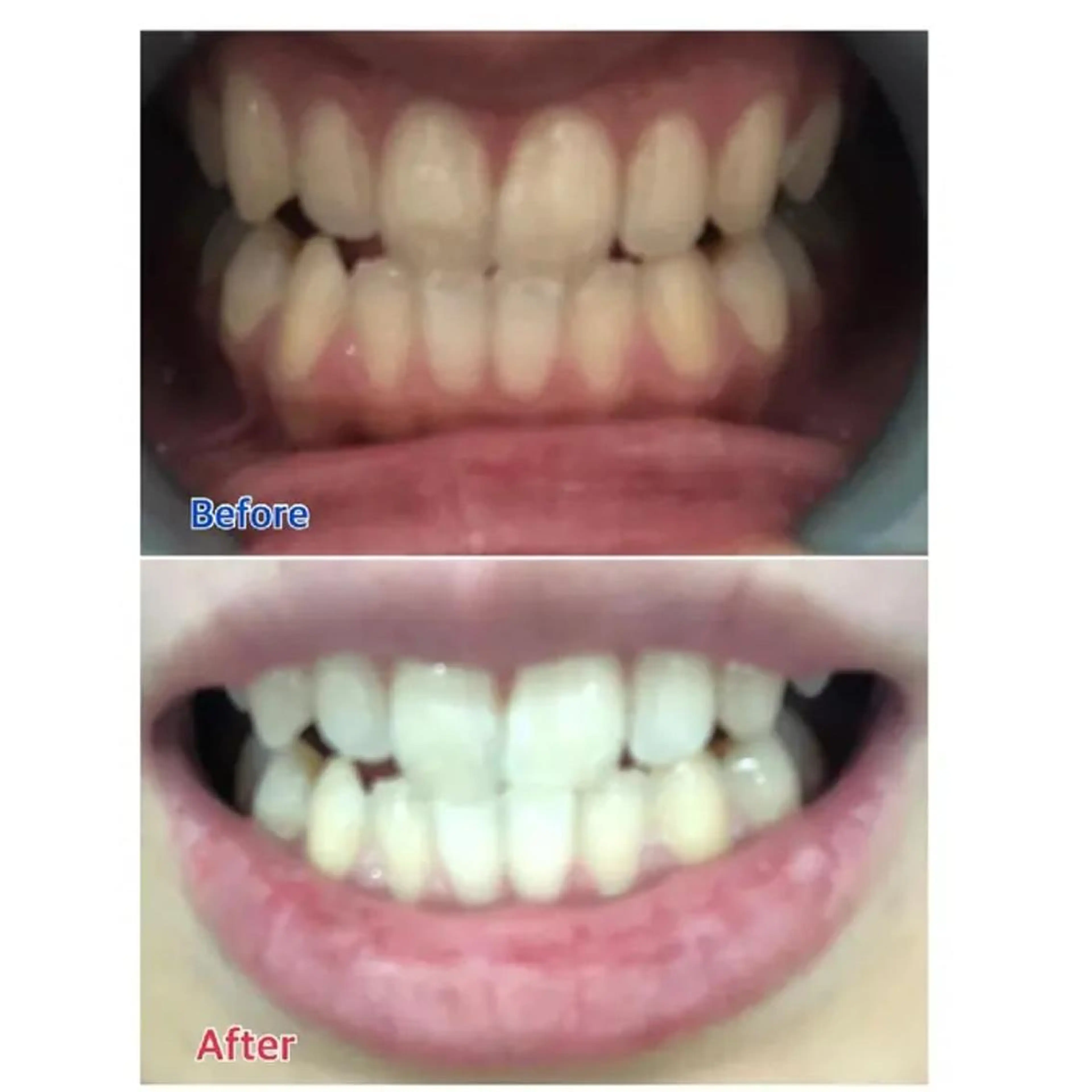 M渋谷店所属・M渋谷 ホワイトニングのエステ・リラクイメージ