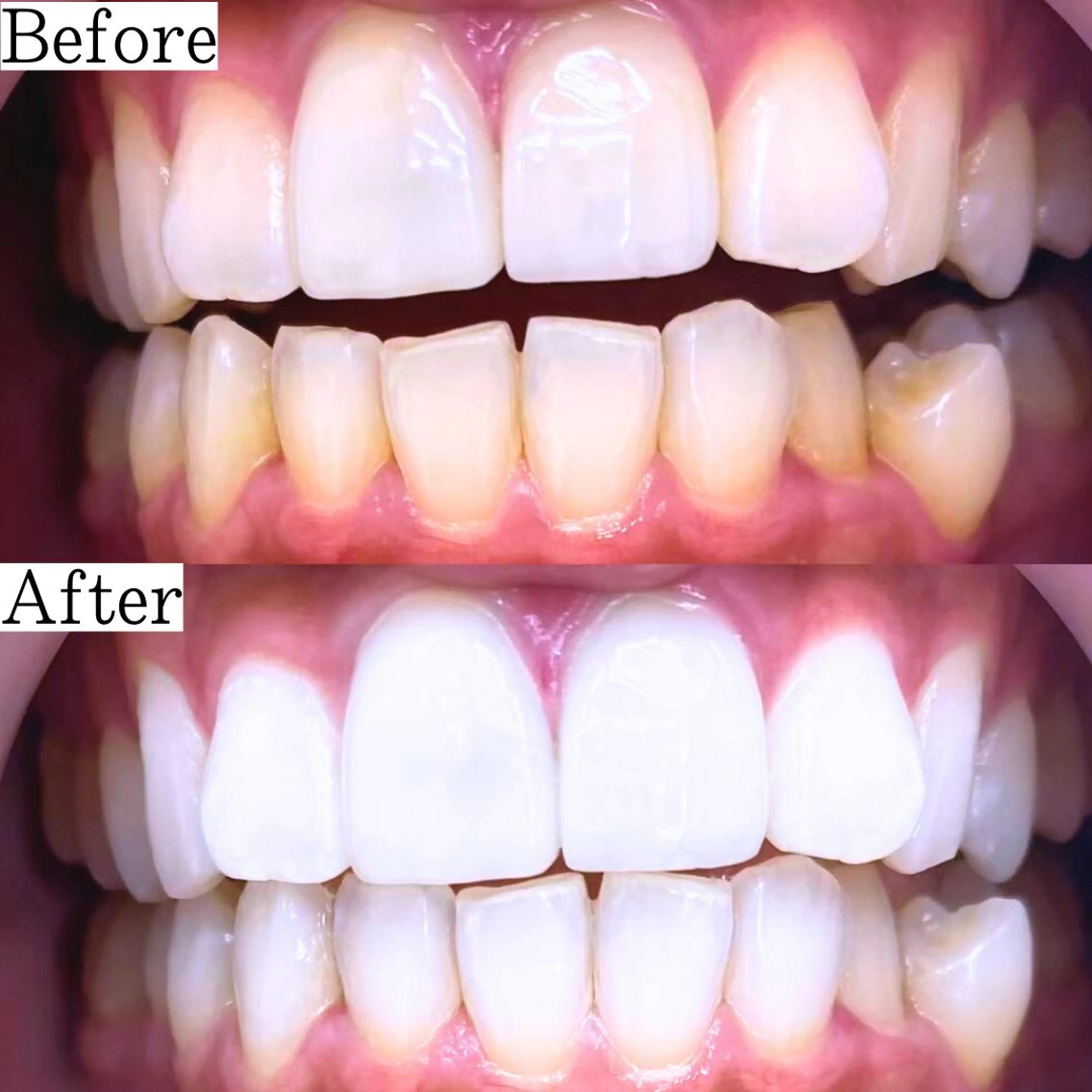 LBSホワイトニング 銀座店💎公式のその他イメージ